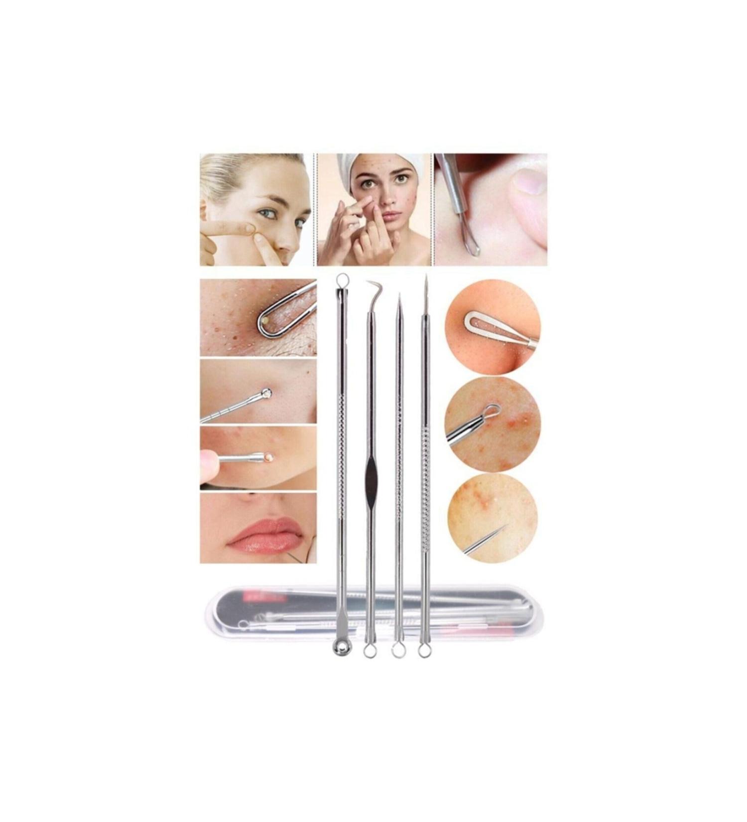 Skygo 4-Piece Boxed Stainless Comedone Acne - Blackhead Cleaner Set