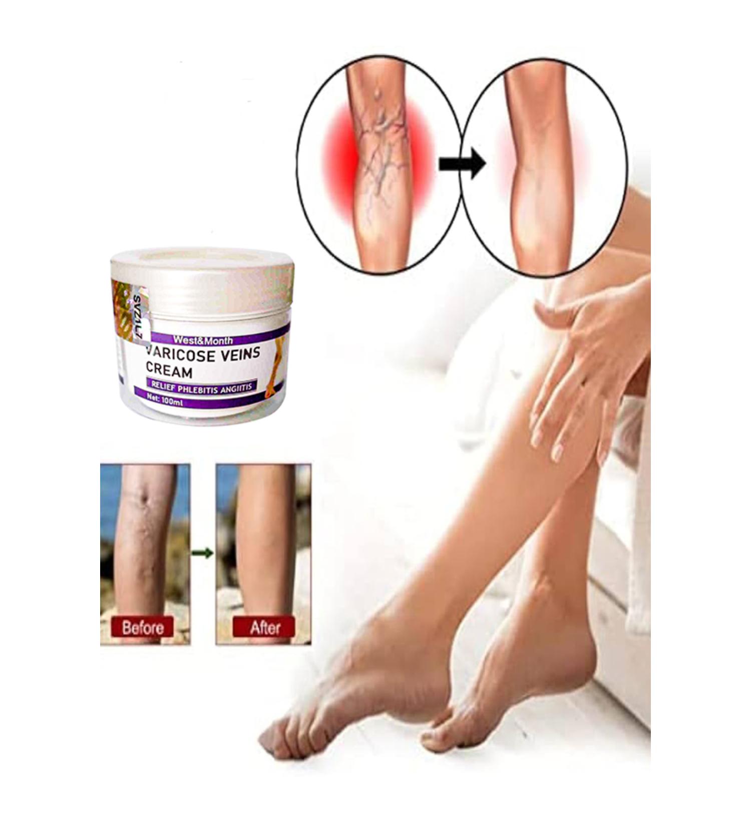 TAMNET Varix Varicose Veins Purple Care Cream 100 ml