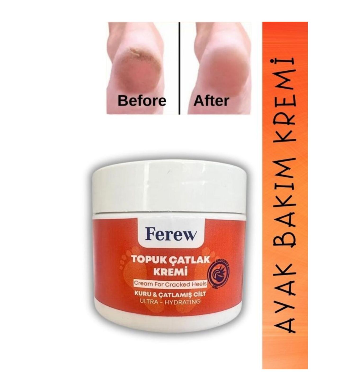 aleyna spice Heel Crack and Foot Care Cream 100 ml