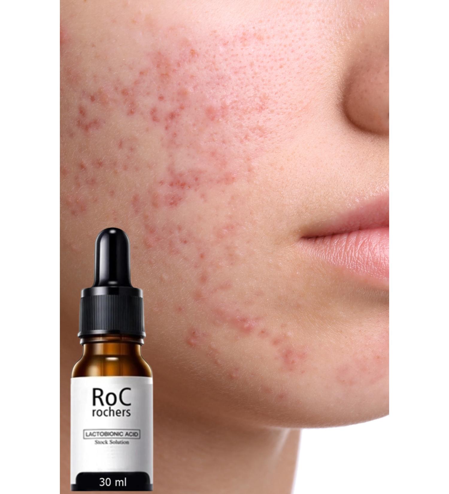 roc rochers Pore Tightening Complex Serum & Vitamin C + Niacinamide + Lactobionic Acid + Hyaluronic Acid - Buy Online on GoSupps.com