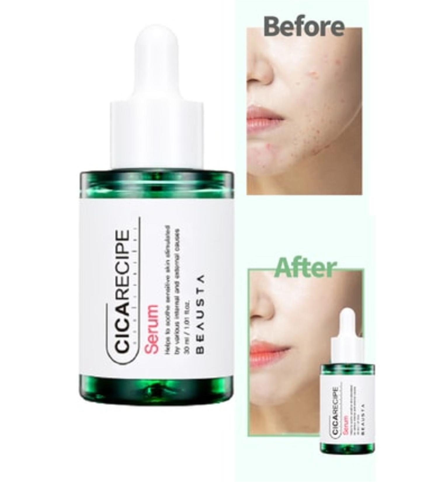 NOVAFACE STD Classic Soothing Anti-Acne Serum with Cica Centella for Sensitive Skin