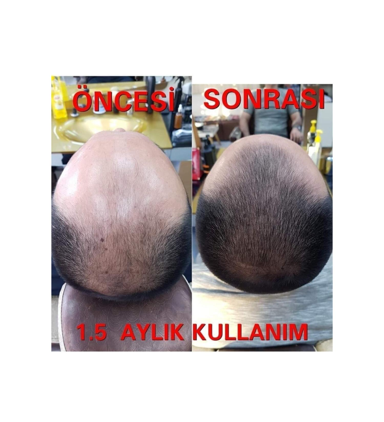 Blue Serum Blue Hair Care Serum Hair Growth Blue Water - Buy Online on GoSupps.com