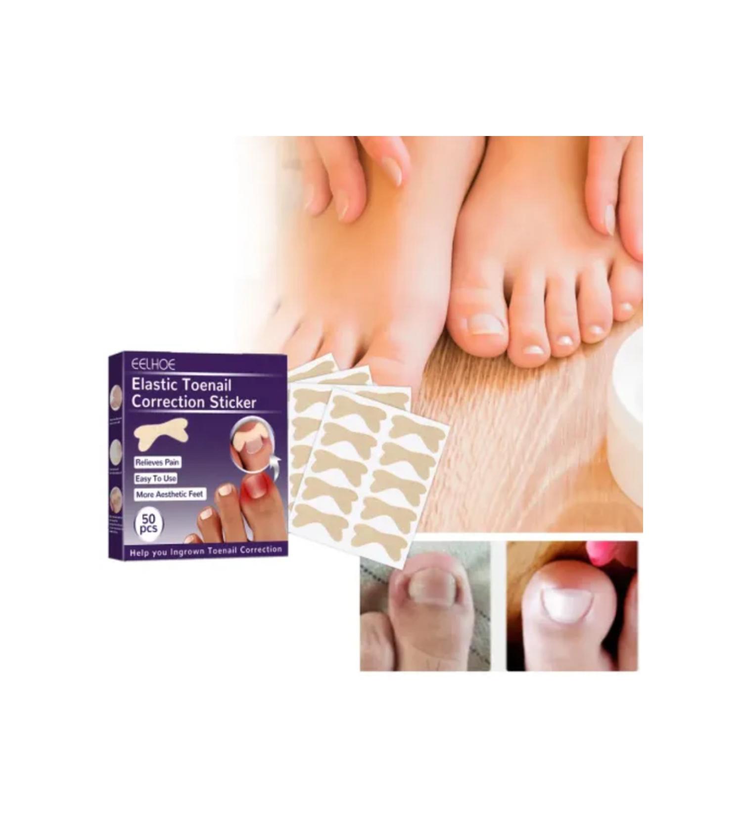 cute bowknot Toenail Tape