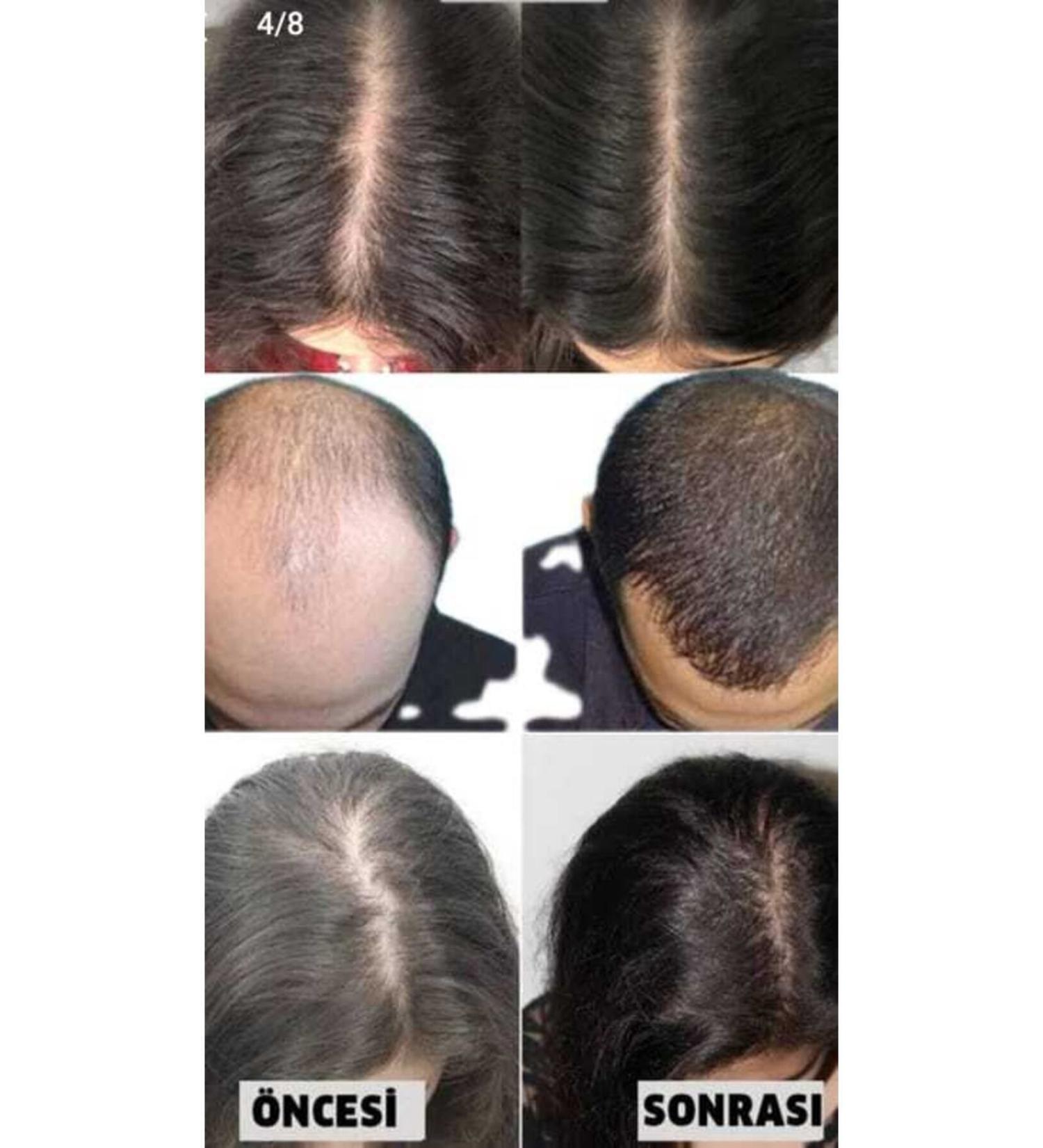 boran cosmetics Hair Care Hair Nourishing - 1 Blue Serum