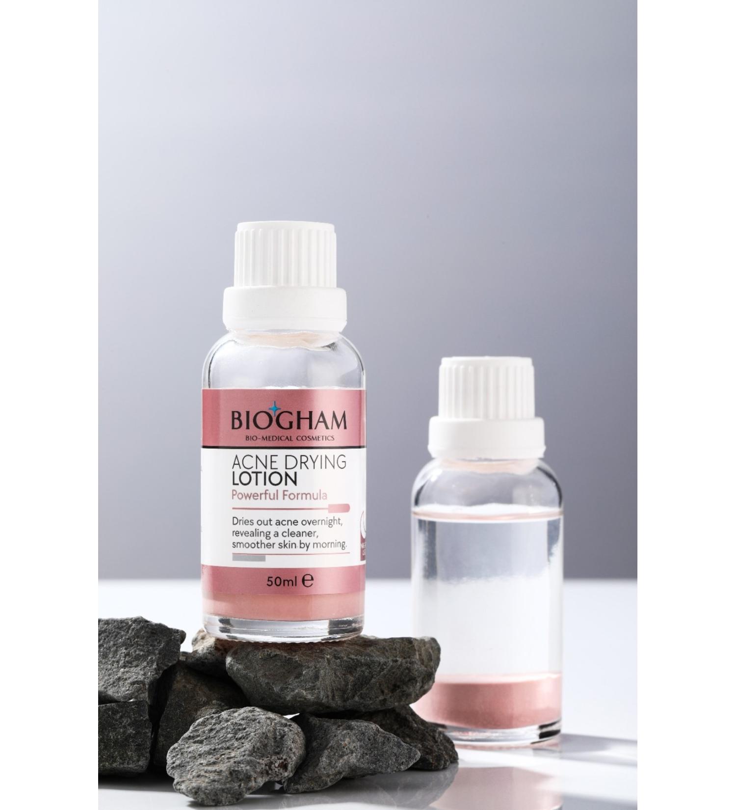 BIOGHAM ACNE DRYING LOTION Bye-bye Acne Spots Wake up to Clearer Skin