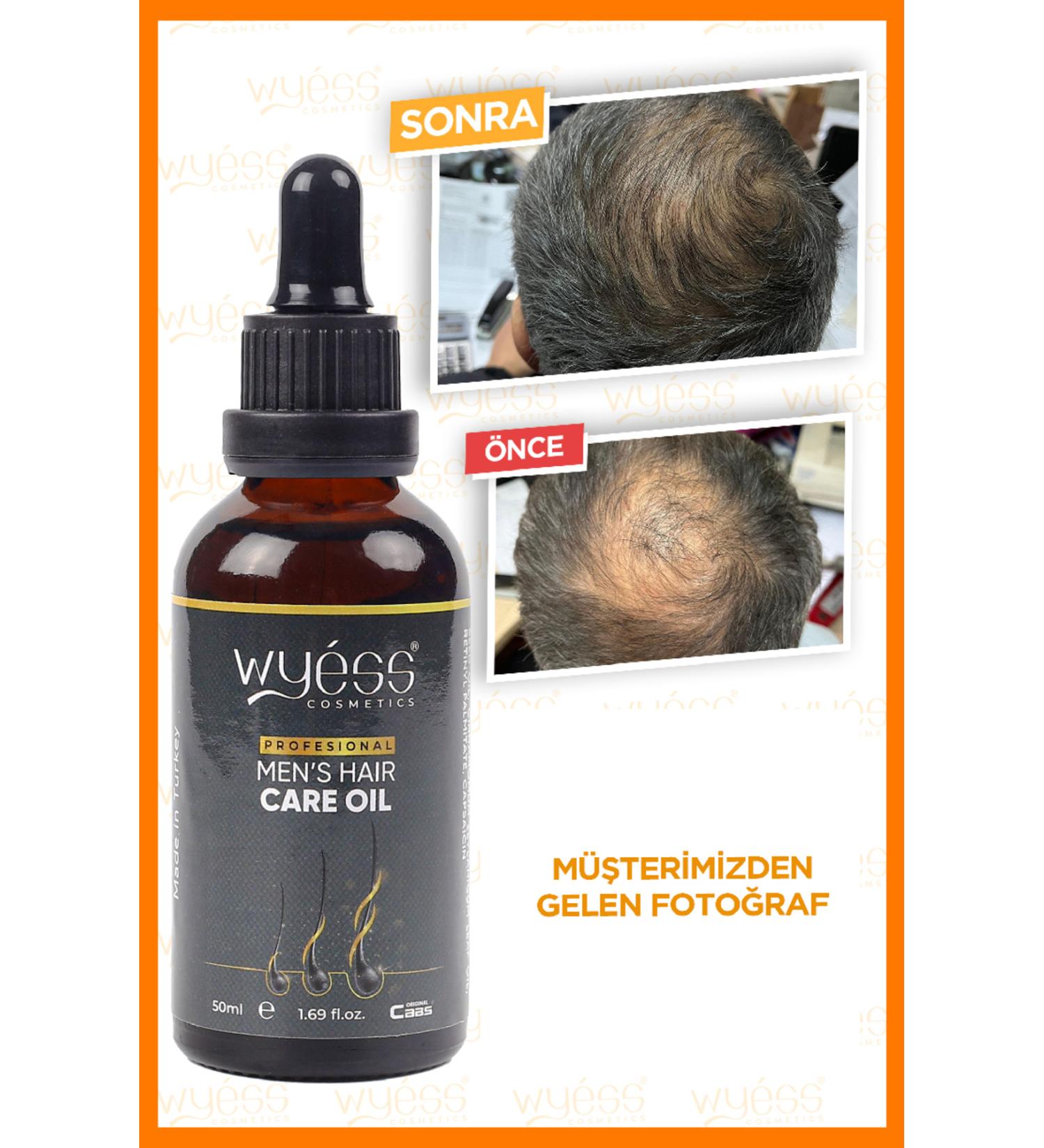 Wyess Men's Hair Care Oil-serum Anti-Loss New Hair Fiber Growth Vitamin E / A 35 Oil 50 ml - Buy Online on GoSupps.com