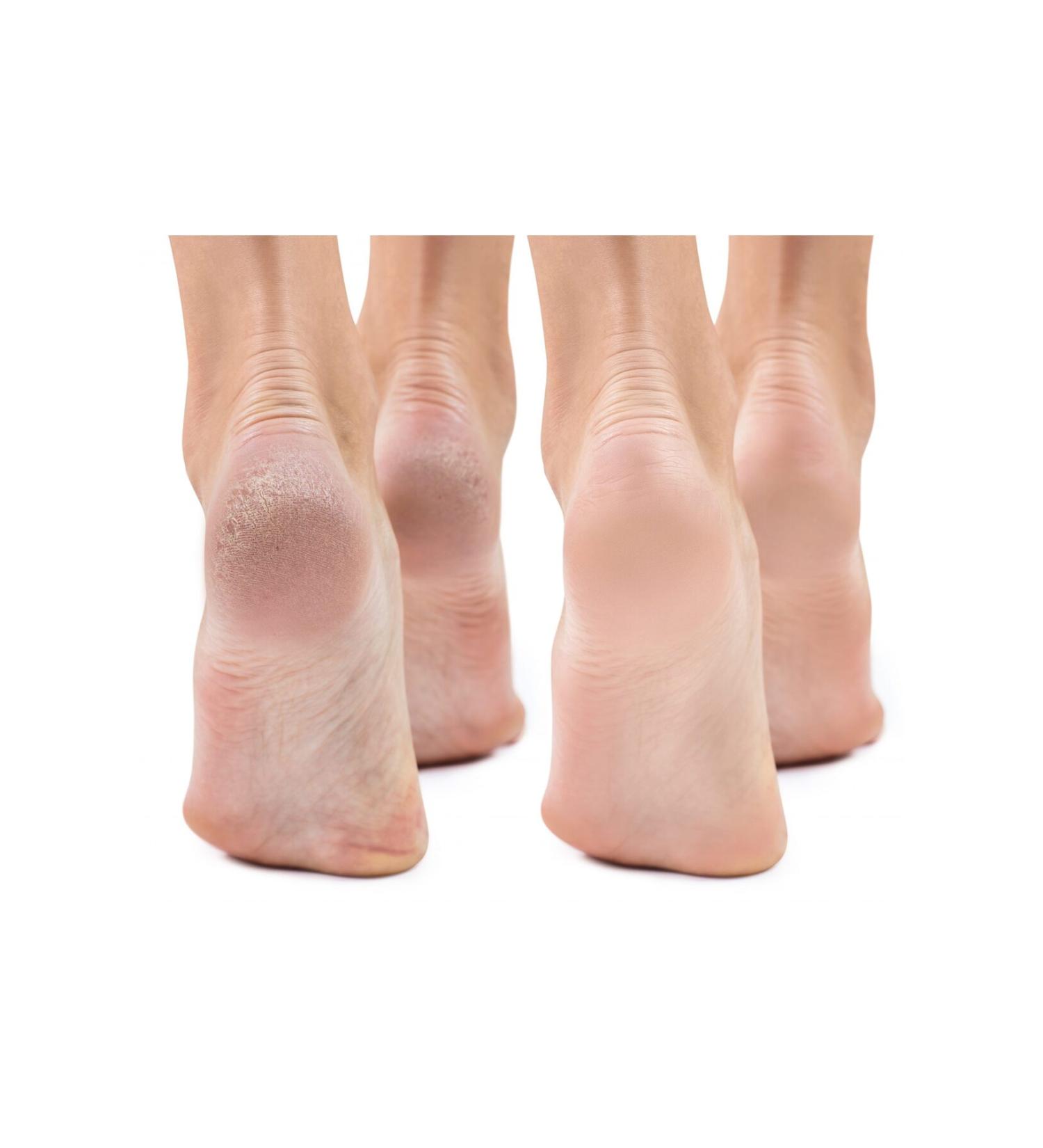 Cabi La'lus Mille Oil-Based Night Mask for Heel Crack