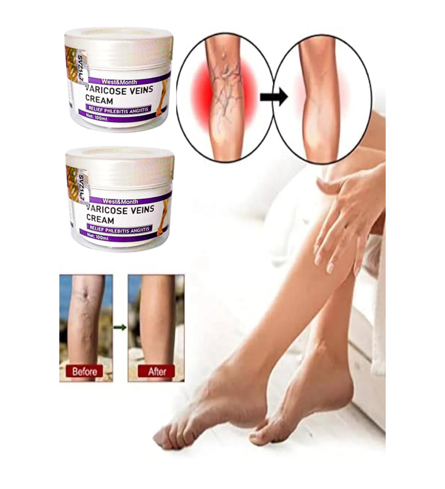Meby Store Varicose Veins Cream West&Month Anti-Cellulite Leg Care Cream 100 ml x 2 Pieces