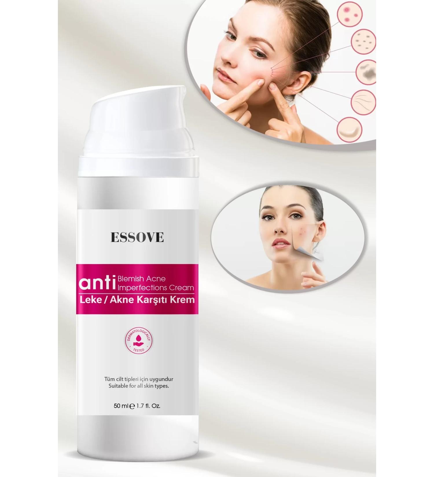 ESSOVE Anti-Spot Acne and Pimple Cream 50 Ml - Buy Online on GoSupps.com