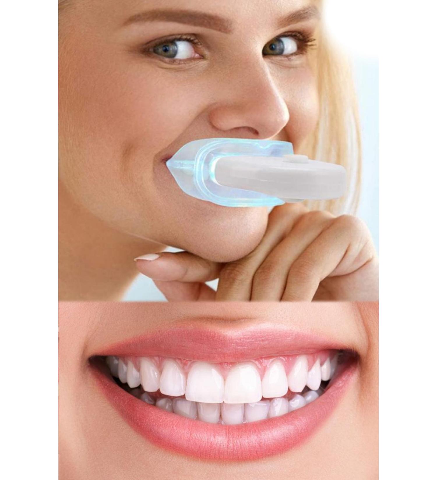 Teeth Whitening Gel - Whitening Gel Teeth Whitener Teeth Whitening Gel | Teeth Lightening Stick - Buy Online on GoSupps.com