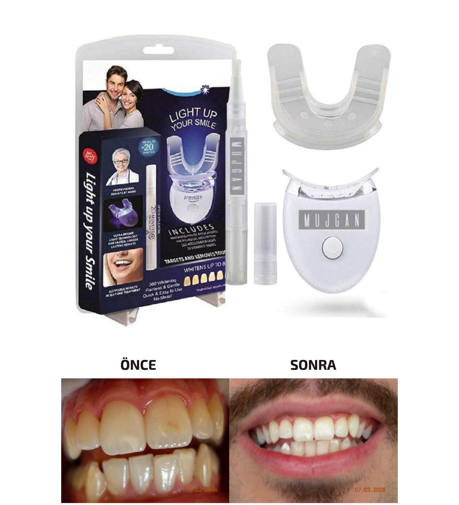Teeth Whitening in 20 Minutes Opale Professional Home Practical Teeth Whitening Tool + 1 Thick Gel UV Light - Buy Online on GoSupps.com