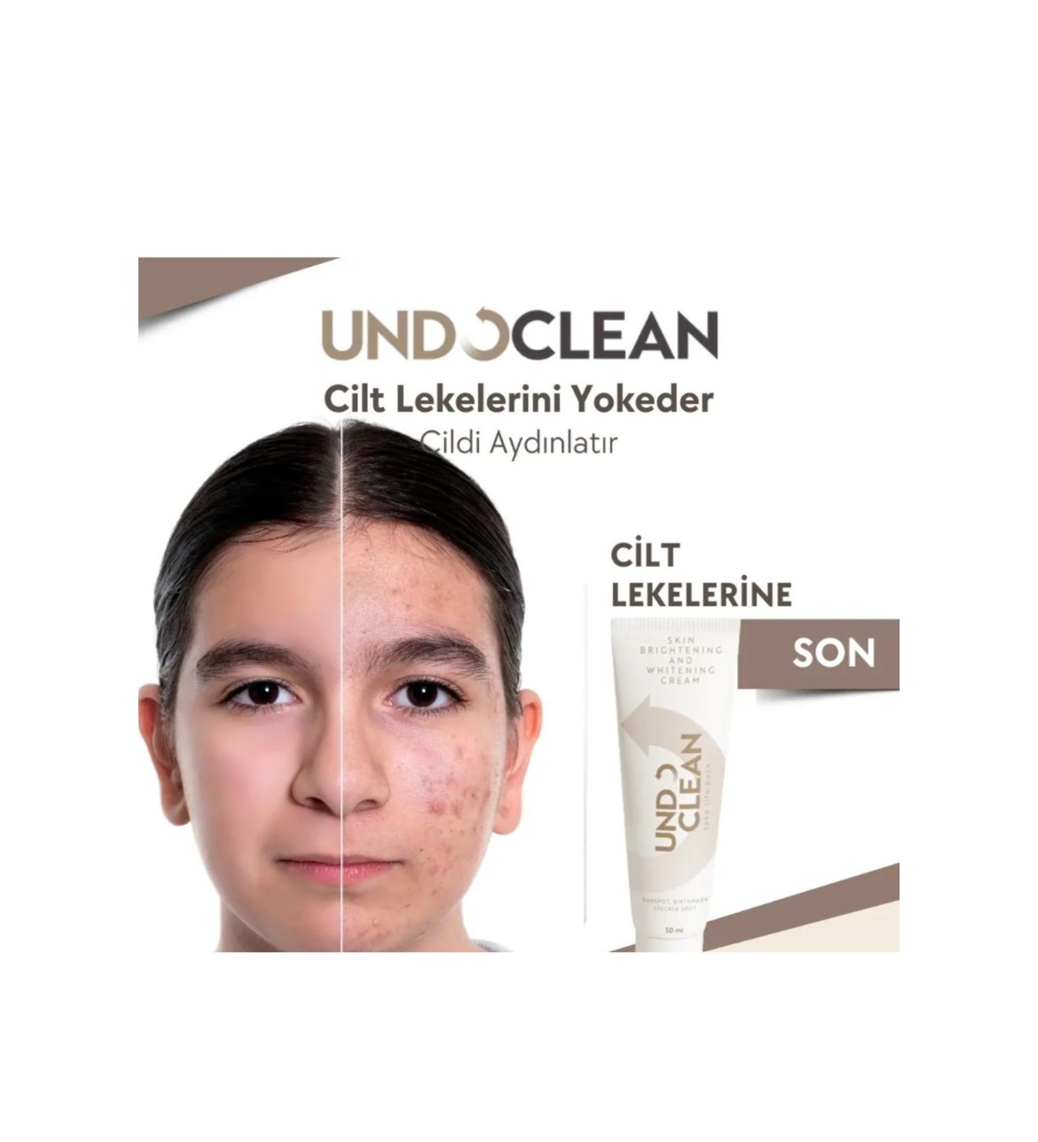 Cream Skin Whitening Cream Undo Clean Brightening Effective Result Against Stains - Buy Online on GoSupps.com