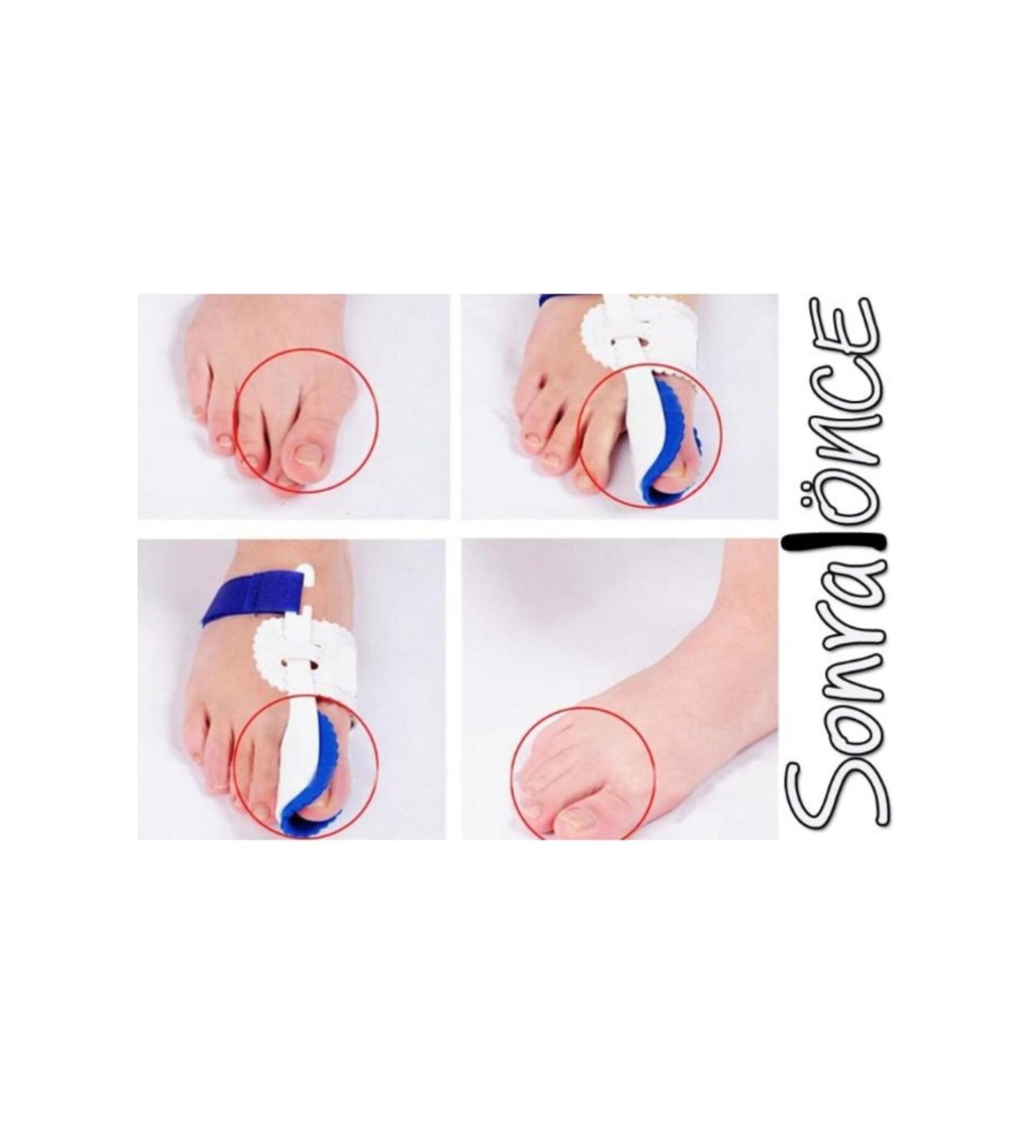 Lisinya Thumb Bone Corrective Night Splint (Pair)