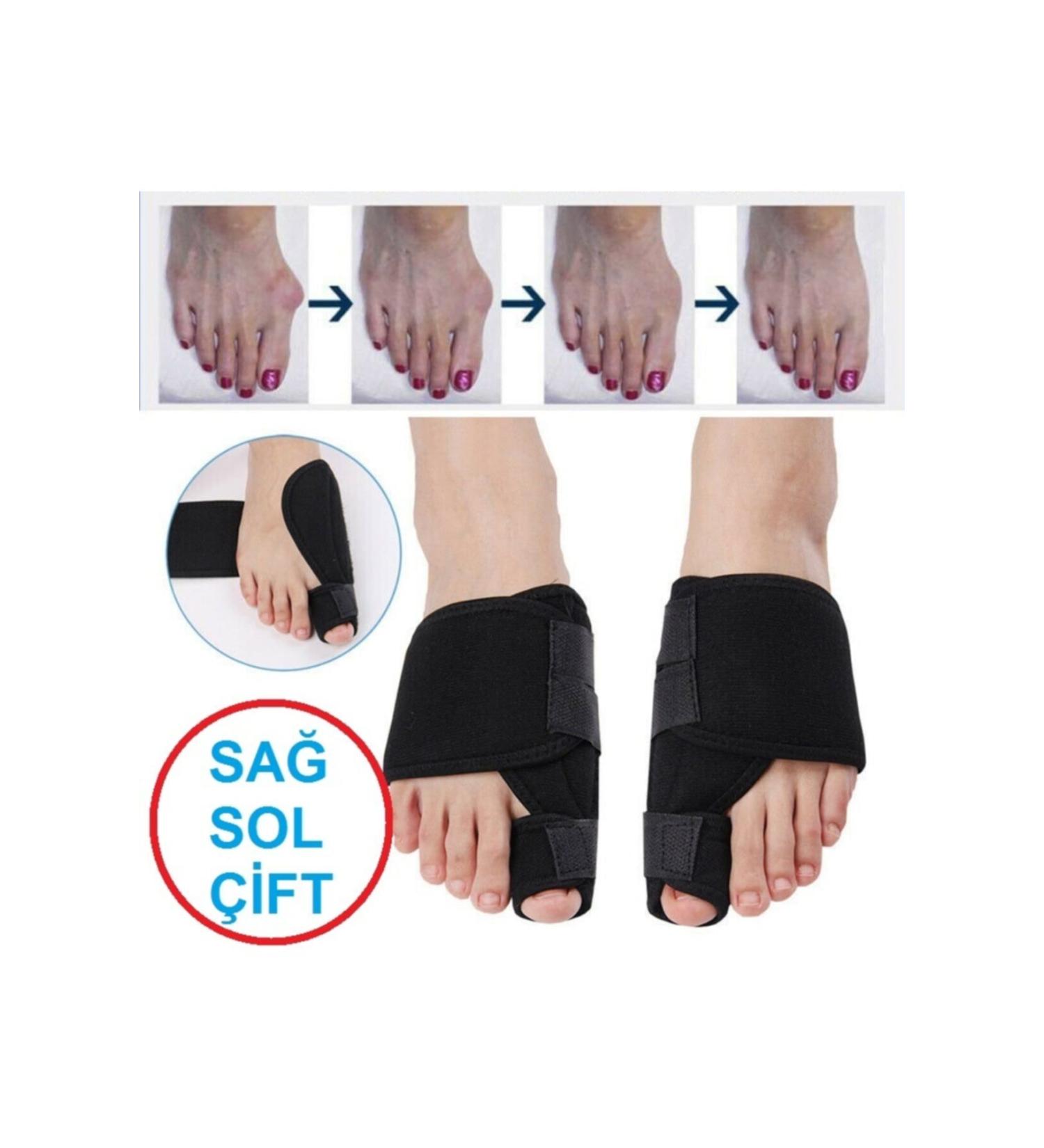 Ankaflex Hallux Valgus Night Splint Hallux Valgus Corrective Treatment Big Toe Bone Protrusion Bunion - Buy Online on GoSupps.com