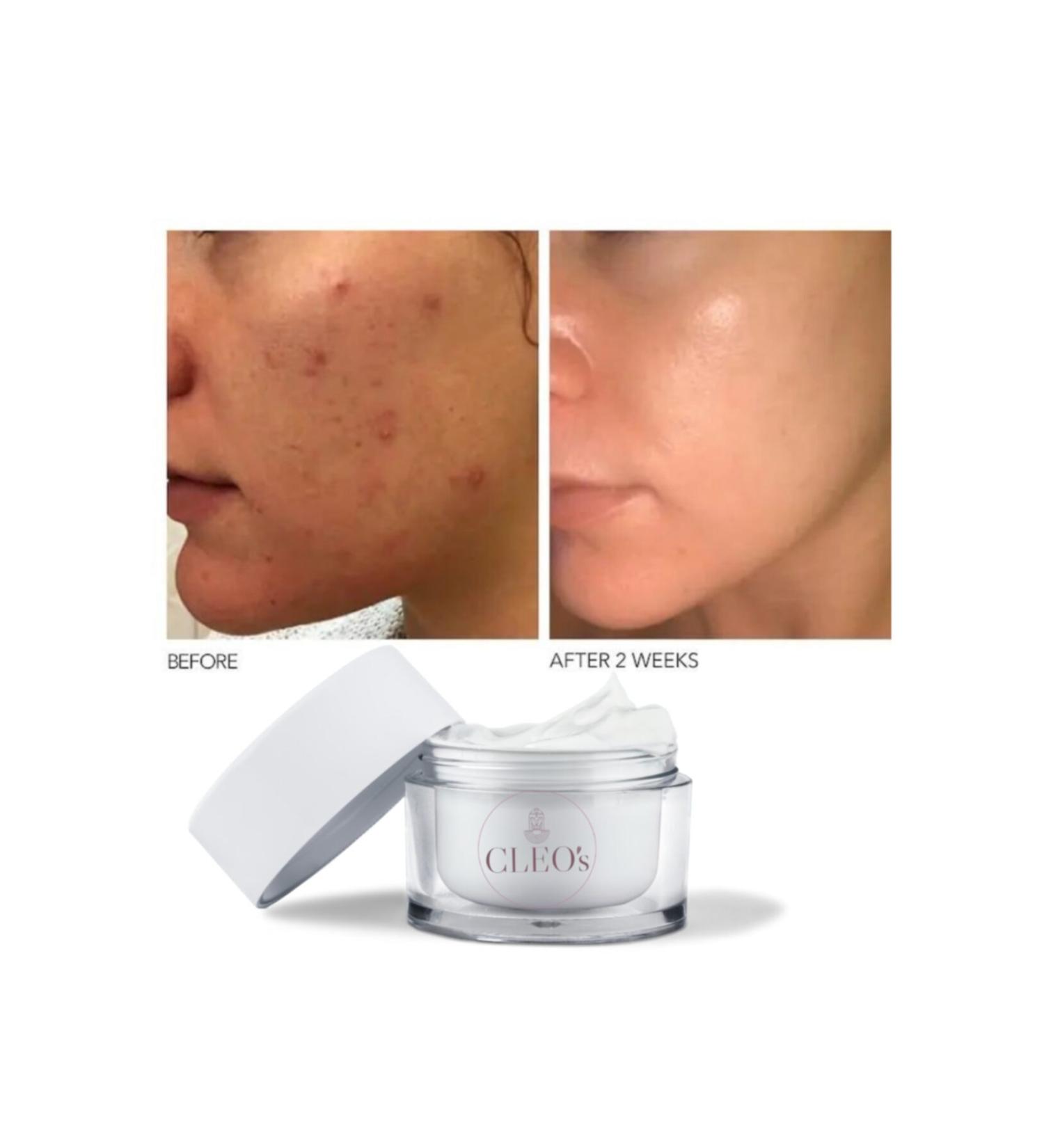 Cleo Care Cream(REPAIR) - Buy Online on GoSupps.com