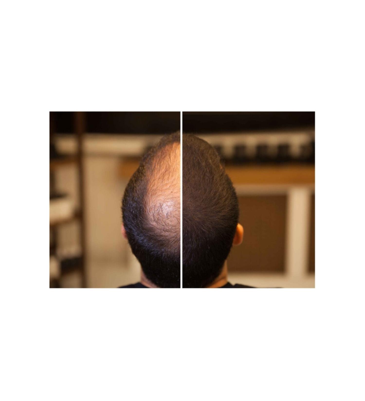 FIXPLANT Hair Plumping Hair Powder Topik 28 Gr. | Get Rid of Thin Hair in 30 Seconds - Buy Online on GoSupps.com