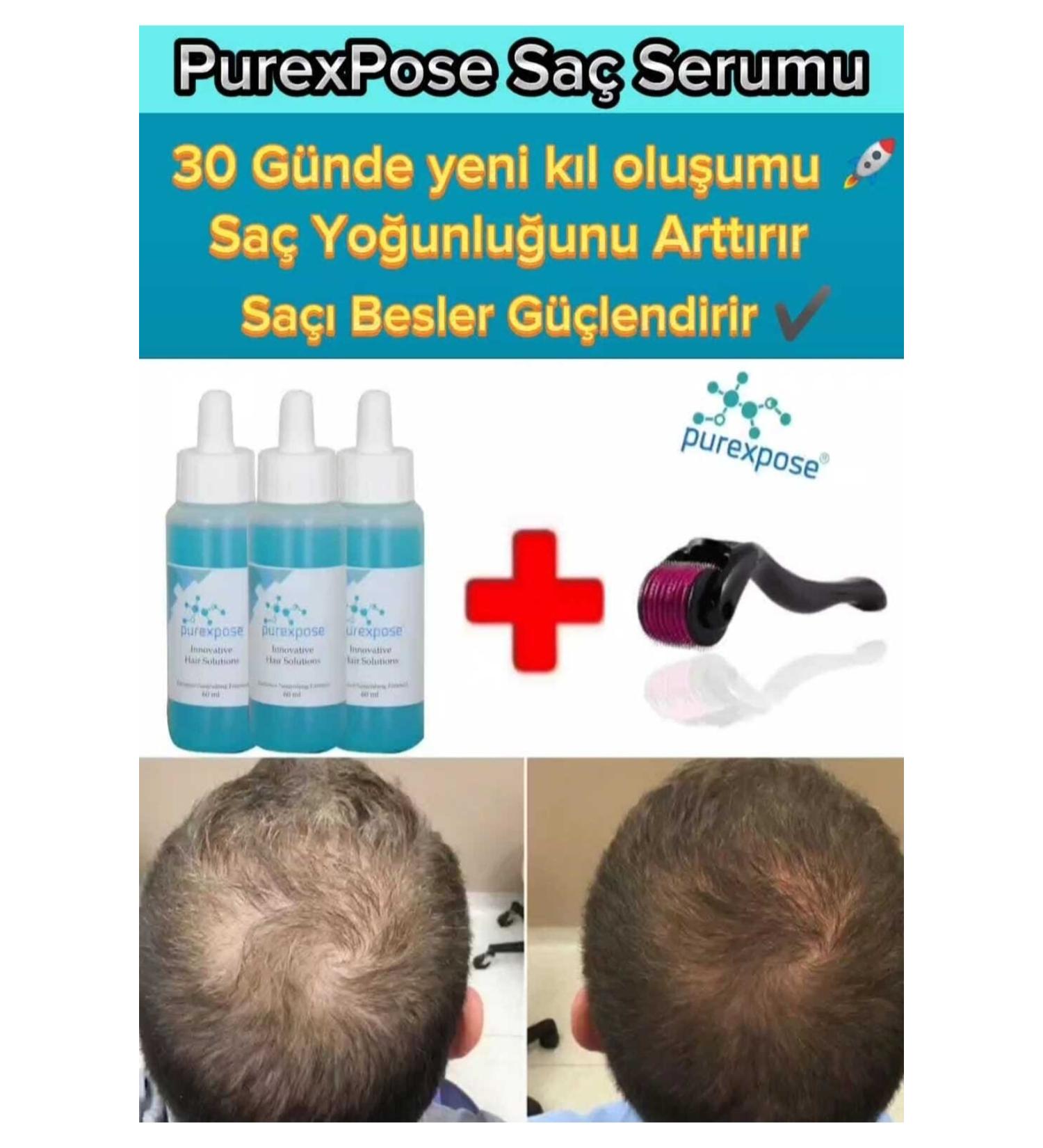 Purexpose Hair Growth Helping Serum Visualizer Growth Preventive Hair Lotion 3 Pieces 1 Dermaroller - Buy Online on GoSupps.com