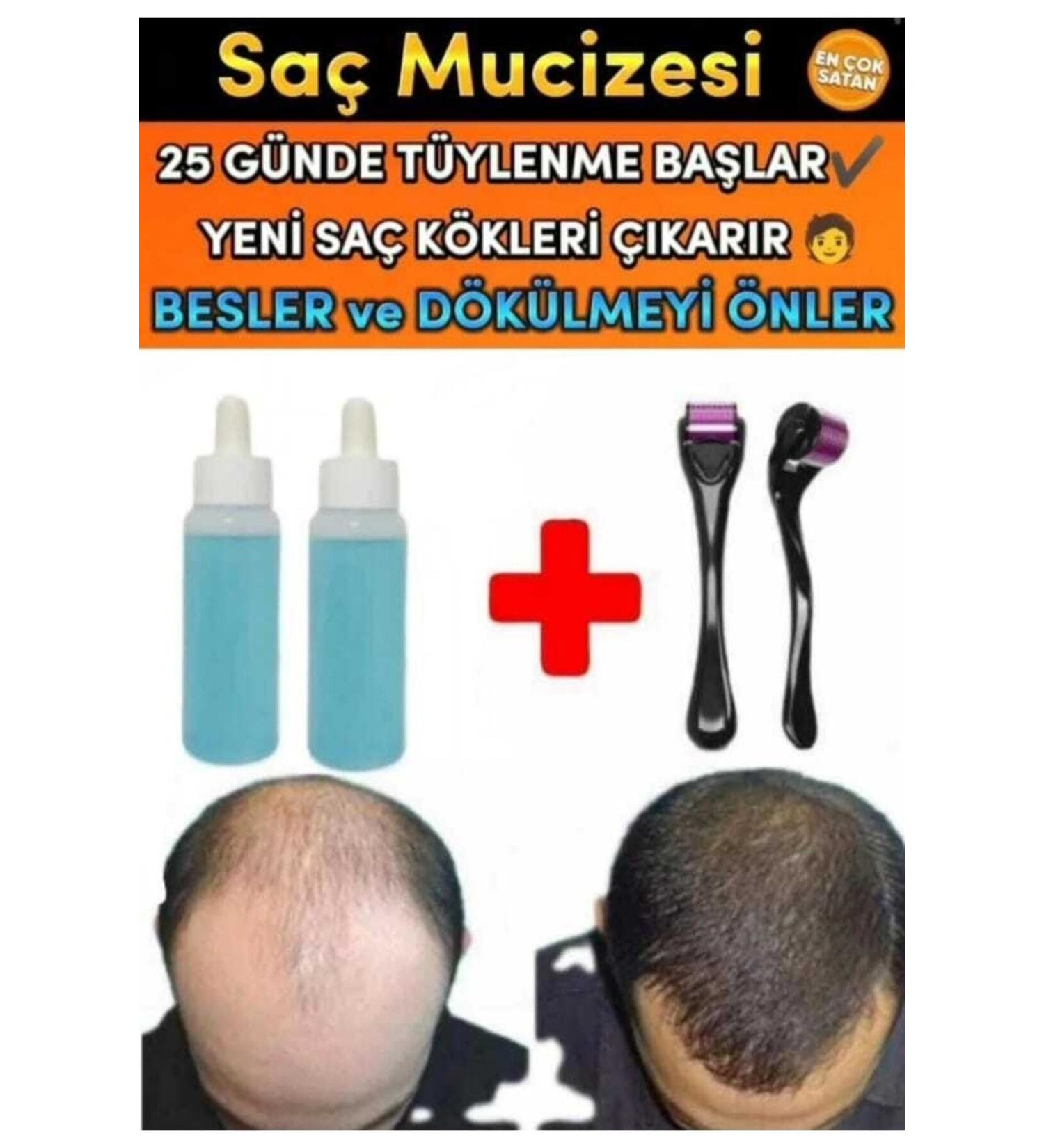 Blue Serum 2 Pieces Hair Care Nourishing Strengthening Hair Growth Lotion 1 Dermaroller Gift - Buy Online on GoSupps.com