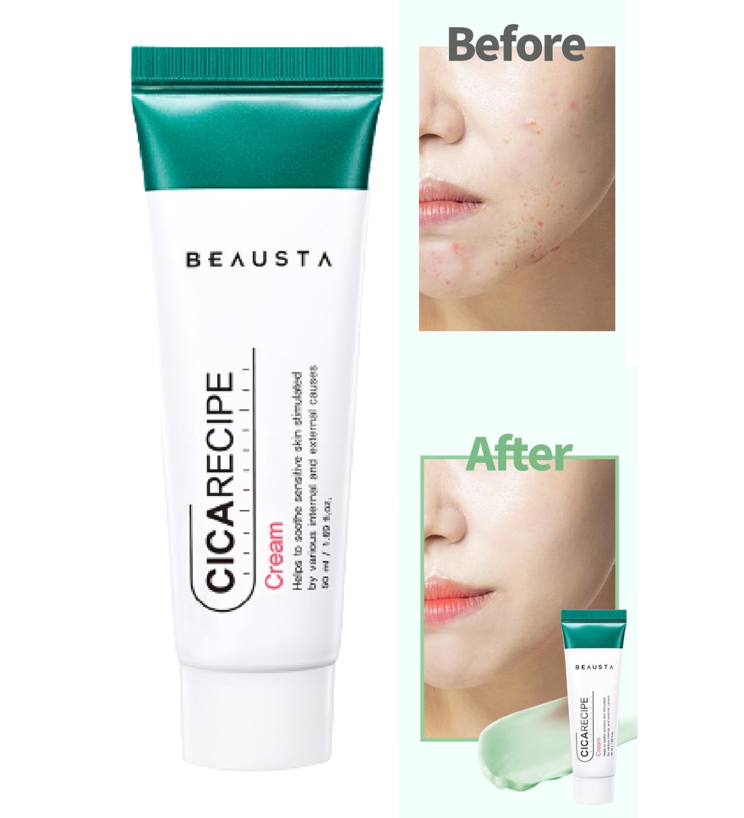 BEAUSTA Cica Barrier Repair Supporting Anti-Acne Moisturizing Cream Cica Repair Cream 50 ml - Buy Online on GoSupps.com