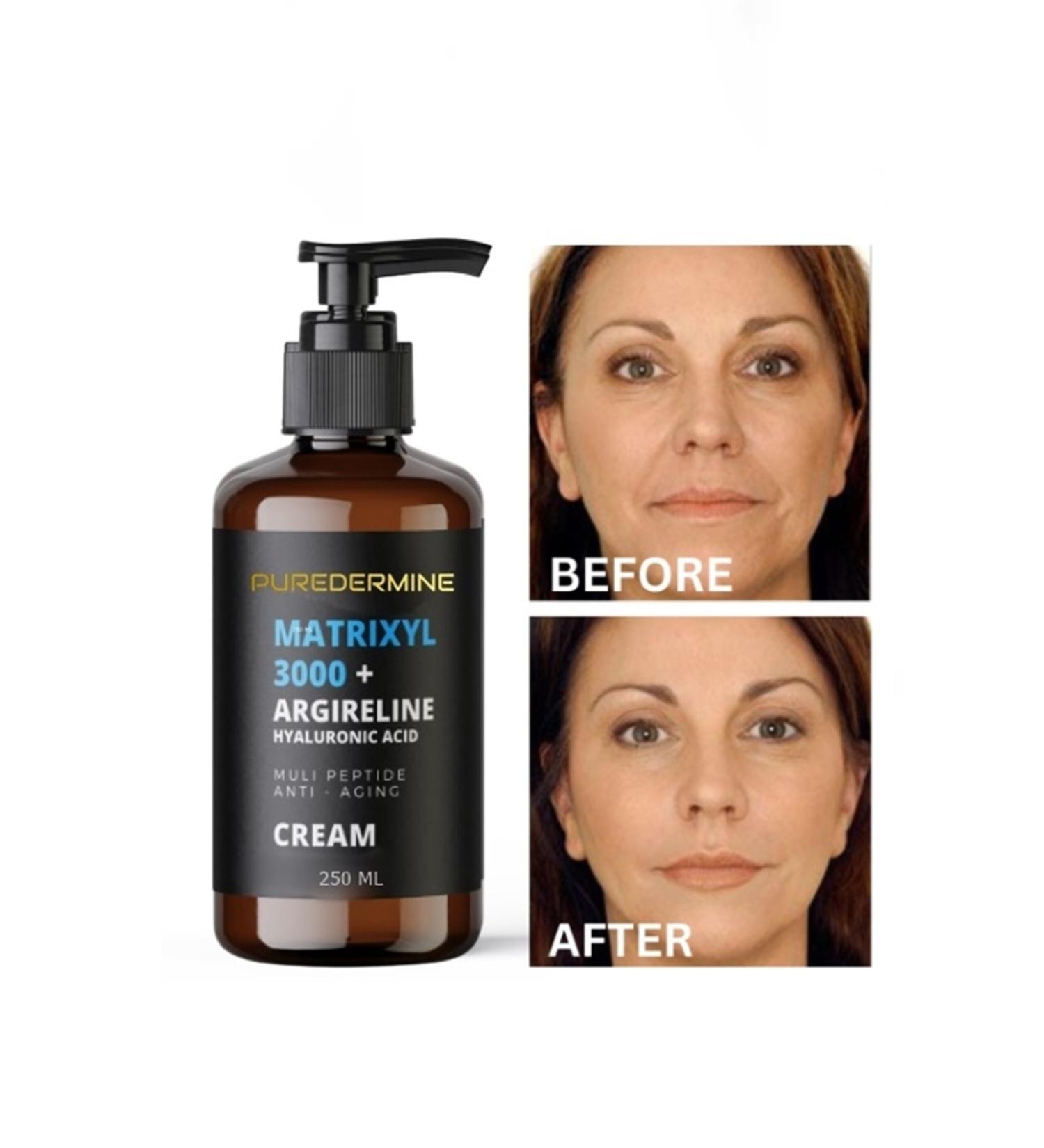 Puredermine Matrixyl 3000 Argireline Hyaluronic Acid Peptide Anti-Aging Serum Wrinkle Cream - Buy Online on GoSupps.com