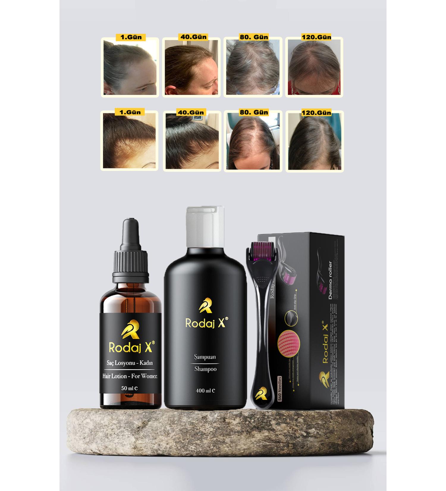Rodaj X Women Hair Growth Helping Serum - Anti-Loss Shampoo - Dermaroller - Buy Online on GoSupps.com