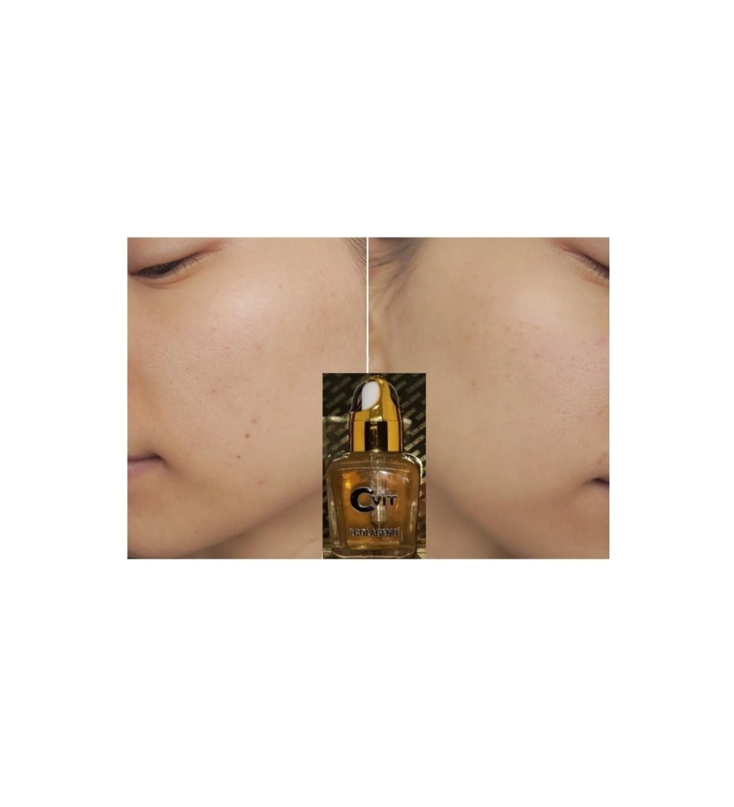PIEL Colageno Vitamin C Skin Serum