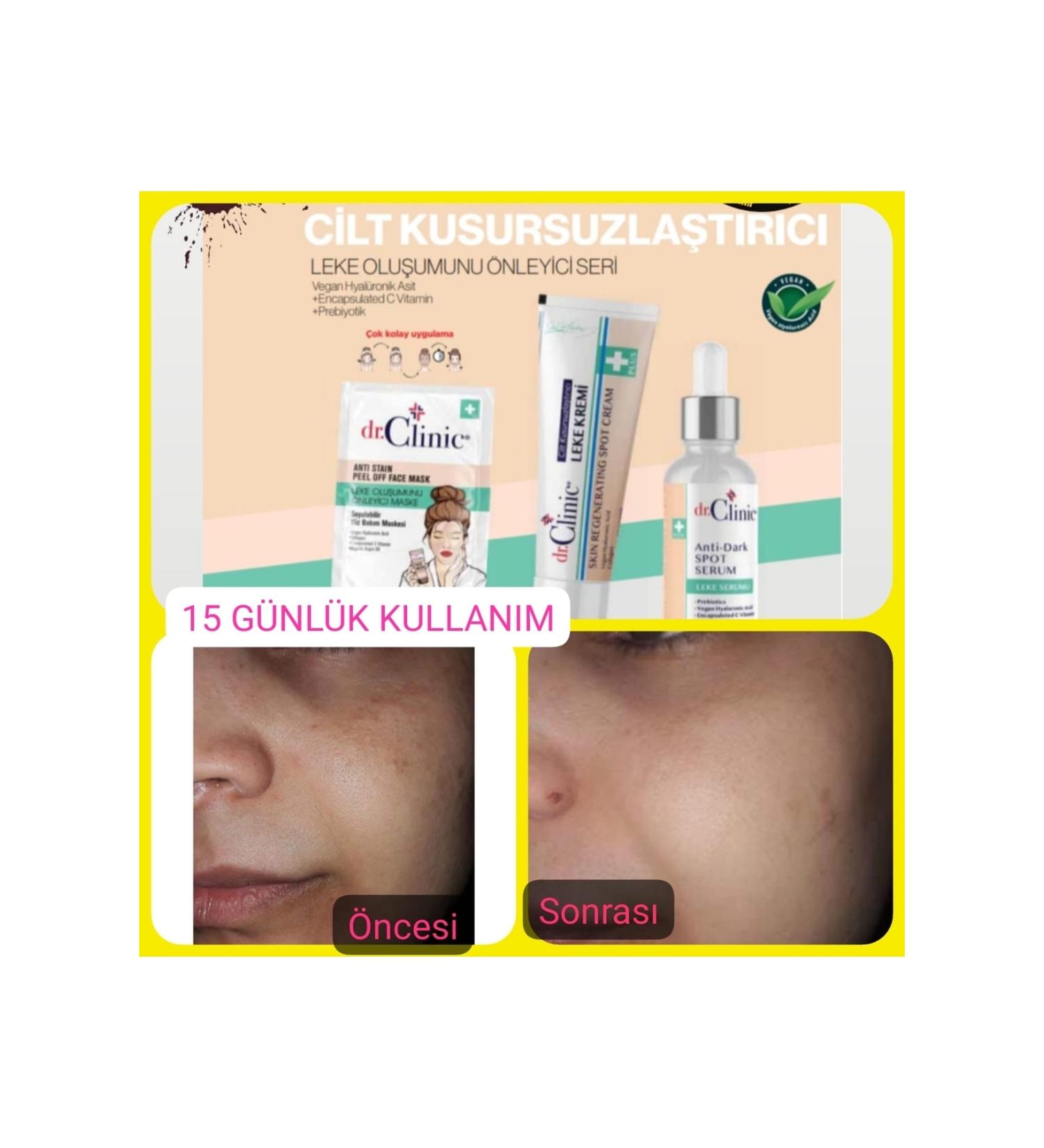 Dr. Clinic Dr.clinic Skin Perfecting Blemish Cream 50 Ml - Buy Online on GoSupps.com