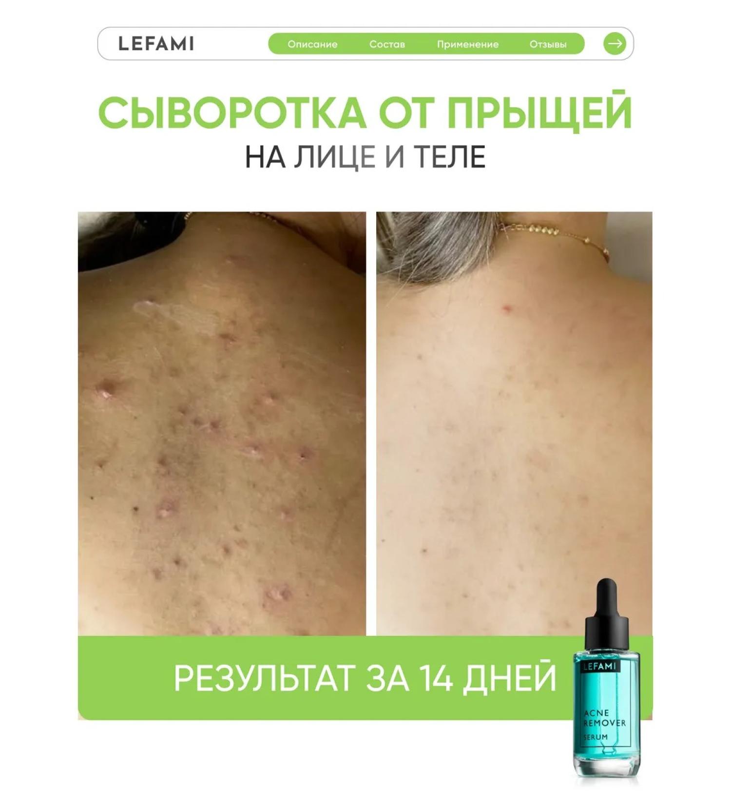 Lefami Permis from acne and black dots for skin and body skin - Buy Online on GoSupps.com