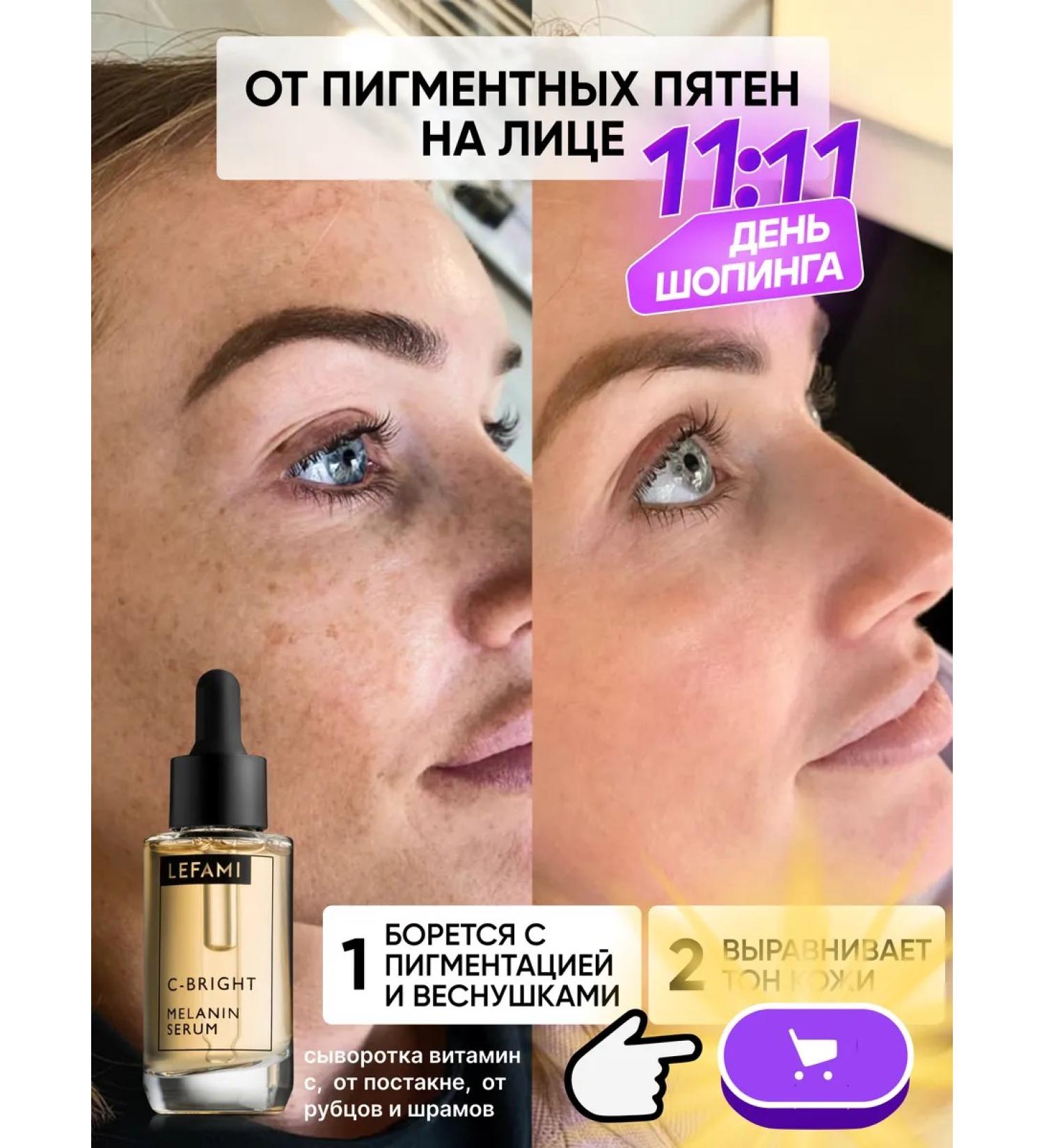 Lefami Wedeously for the face from post -acne and acne with niacinamide - Buy Online on GoSupps.com