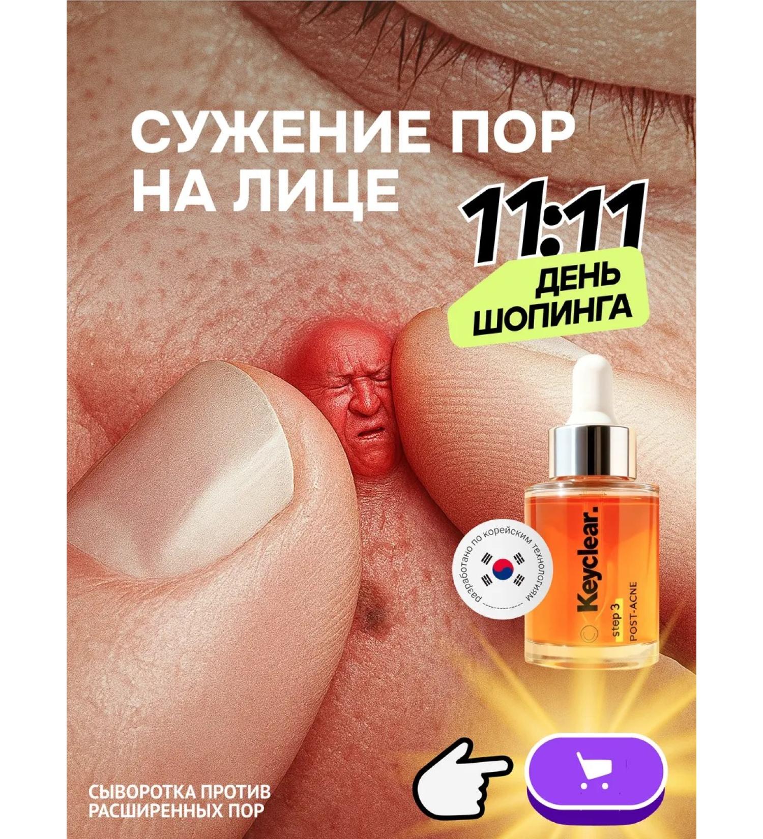 KEYCLEAR Facial serum from acne and black dots - Buy Online on GoSupps.com