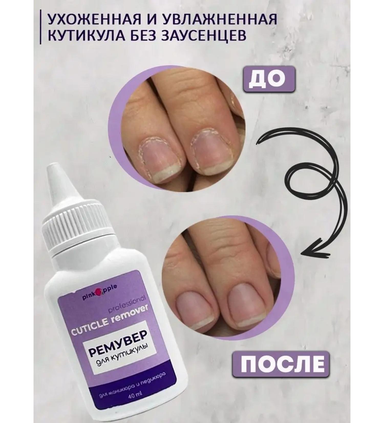 PinkApple Remover for the cuticle Professional