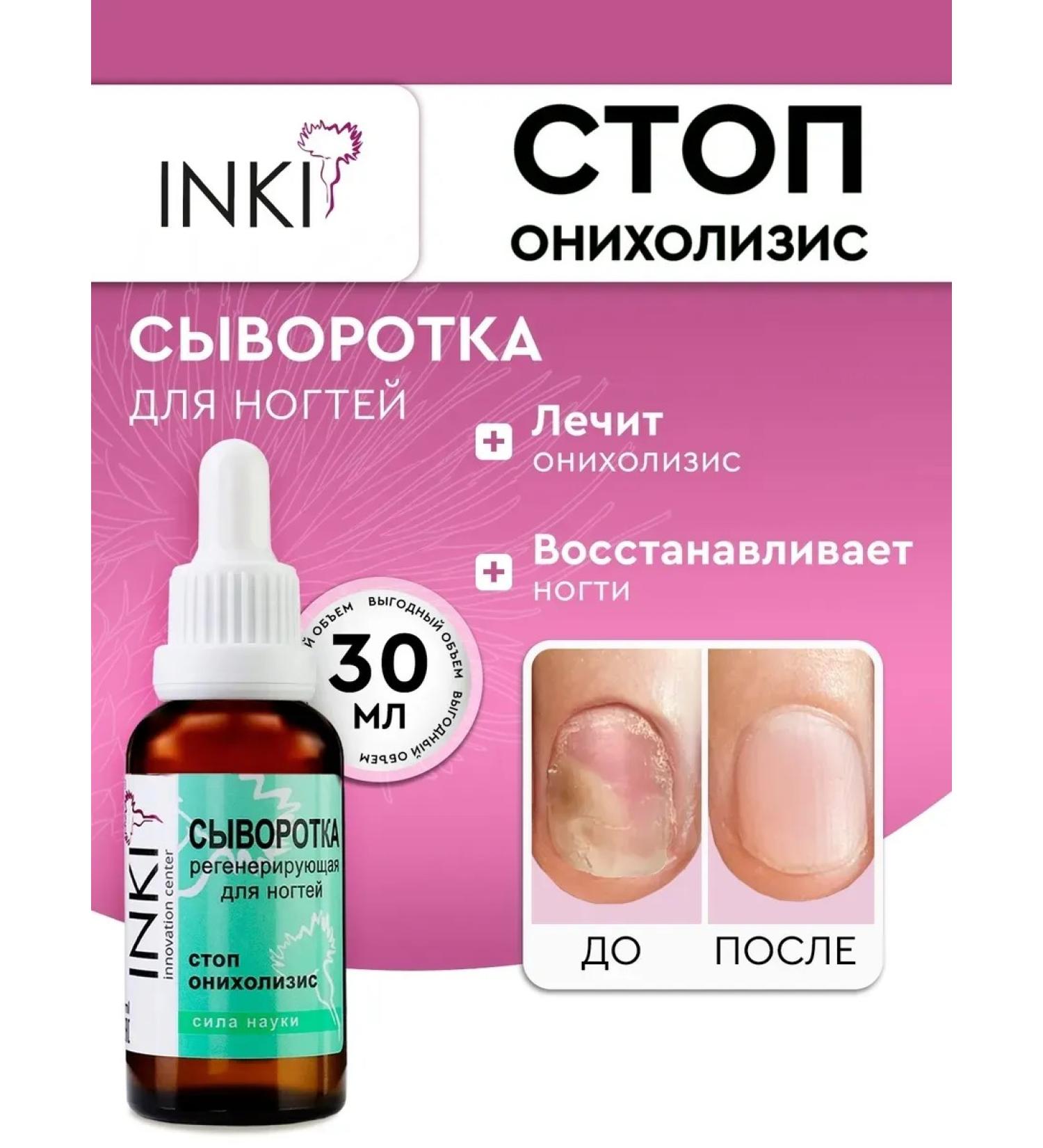 INKI Casting serum onycholysis remedy for nail treatment 30 ml - Buy Online on GoSupps.com