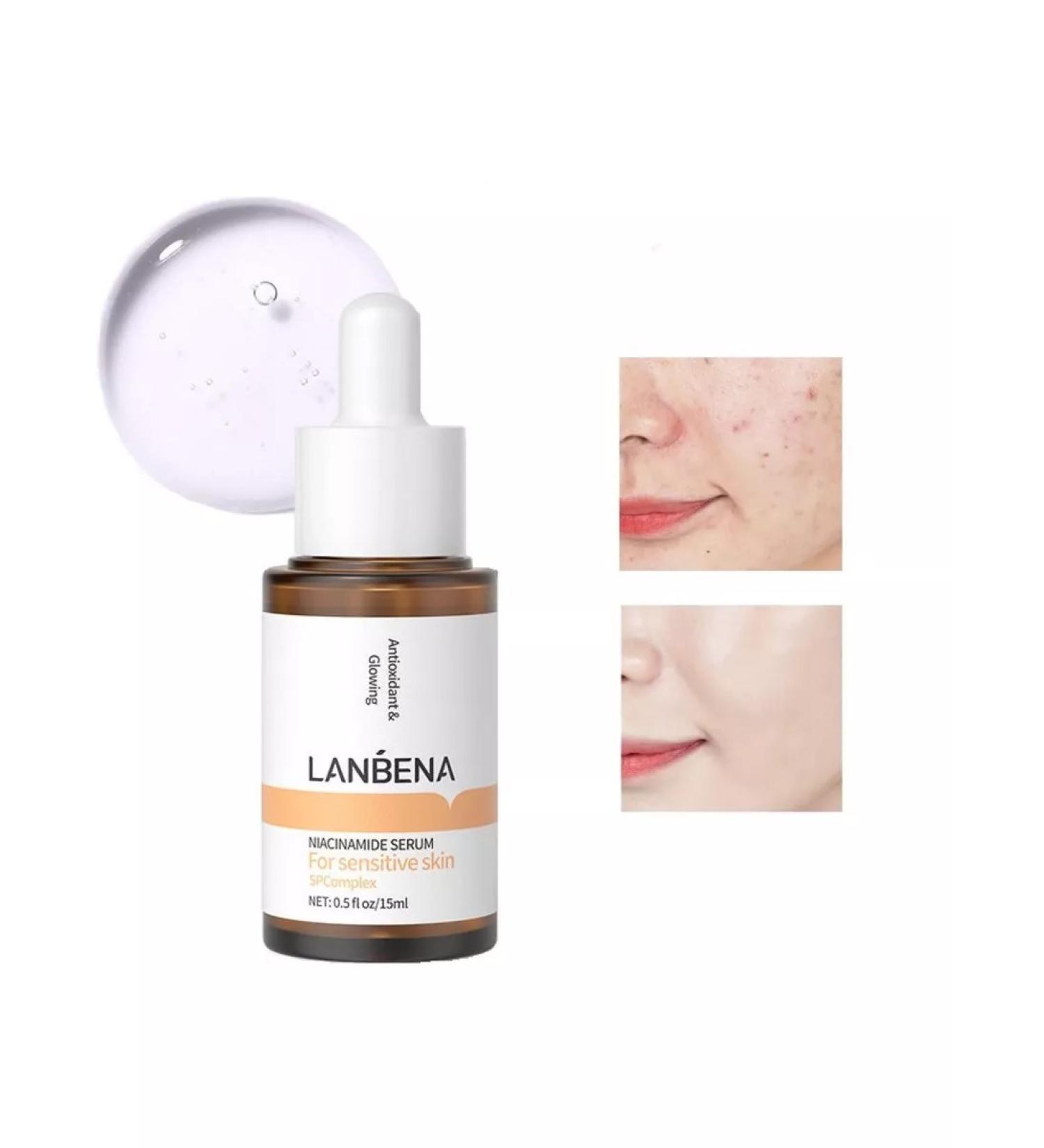 LANBENA From acne whey with niacinamide 30 ml - Buy Online on GoSupps.com