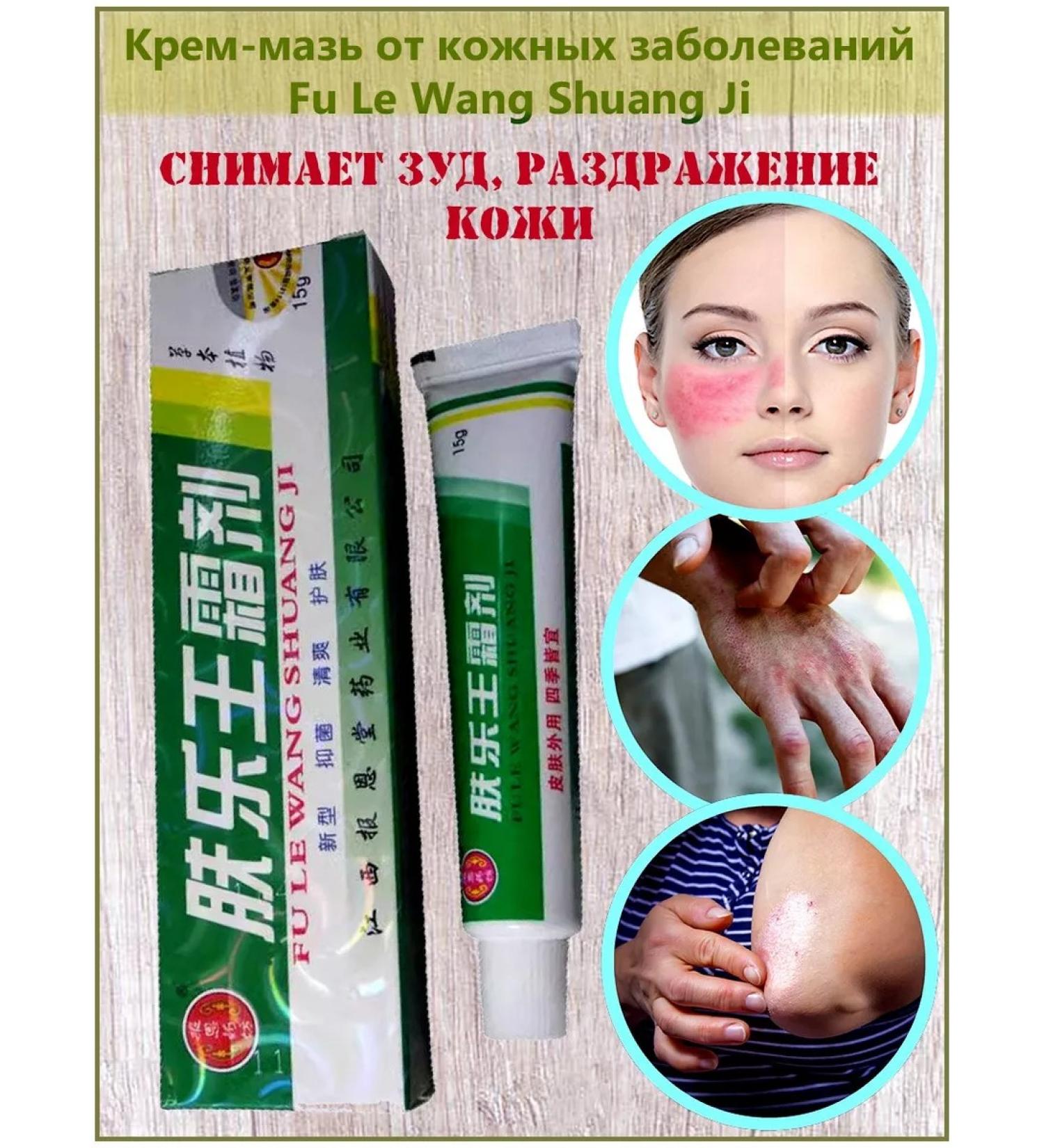 Fun Fair Cream mases from skin diseases Fu Le Wang Shuang Ji