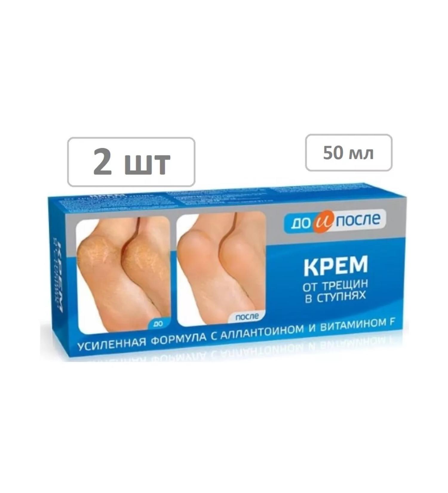 Before and After Cream from cracks in the feet of 50 ml - 2 pcs