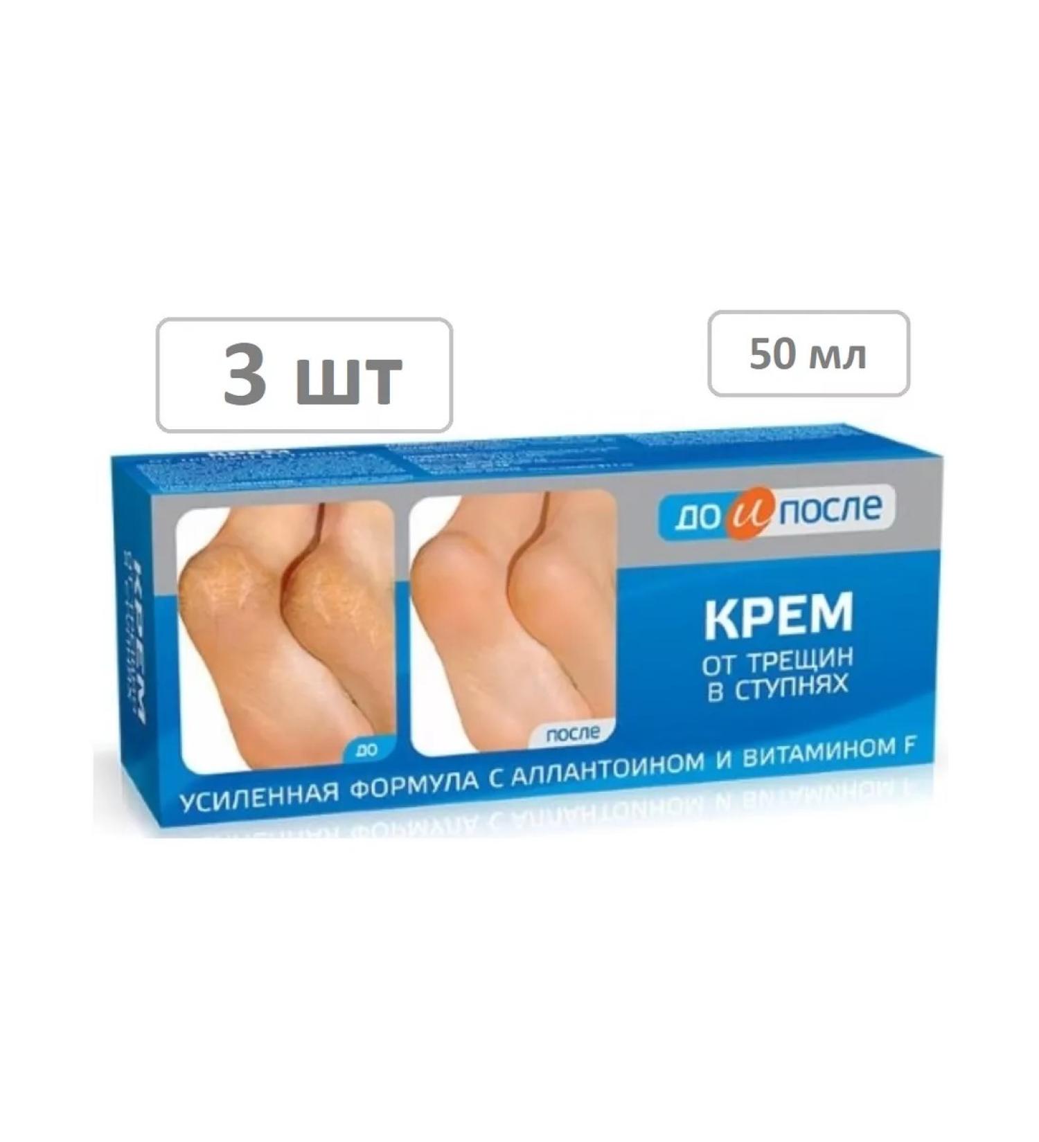 Before and After Cream from cracks in the feet of 50 ml - 3 pcs