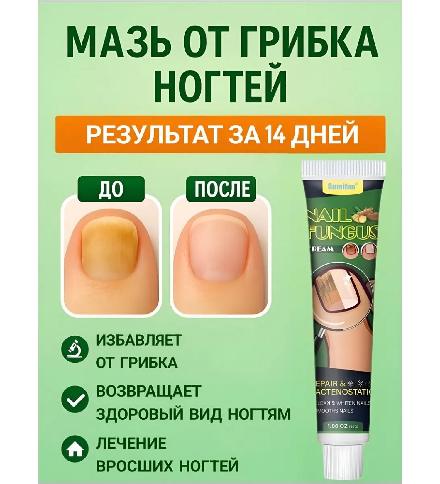 LAMIIA KING Nail fungus agent 30 g - Buy Online on GoSupps.com