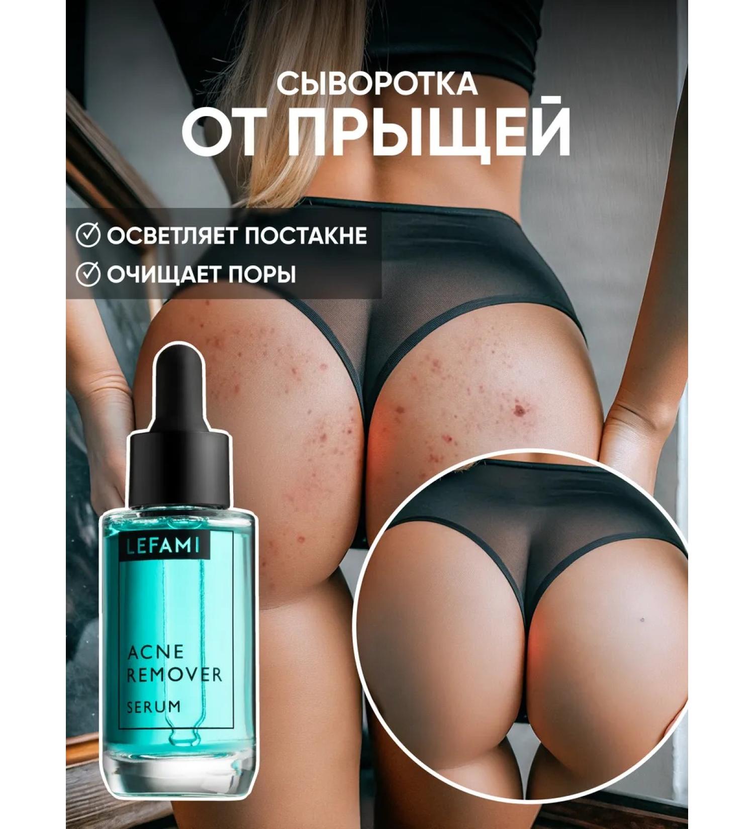 Lefami Serum with niacinamide from acne and acne - Buy Online on GoSupps.com