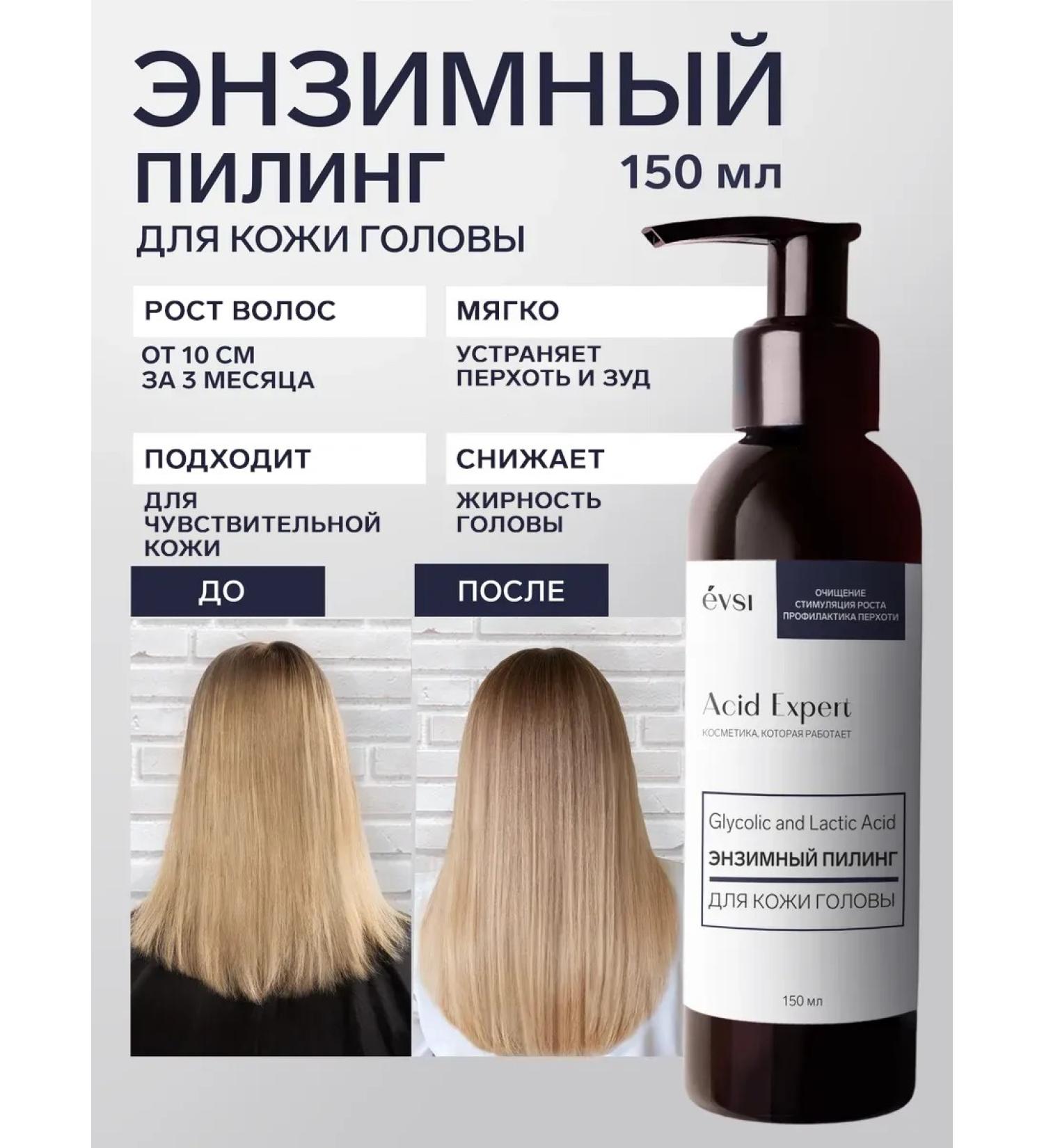 EVSI Hair growth peeling - Buy Online on GoSupps.com