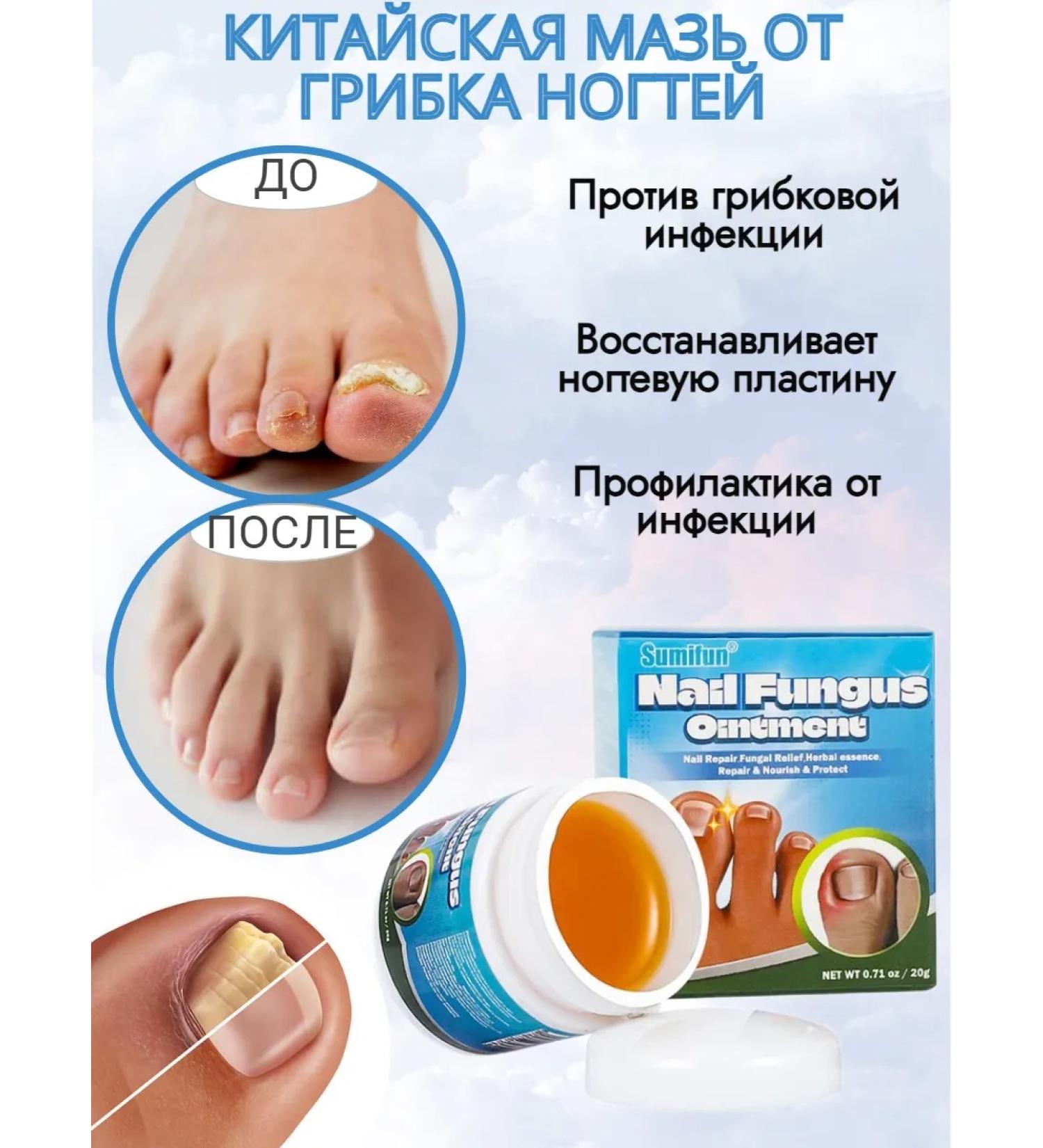 100% Original Chinese remedy for nail fungus - Buy Online on GoSupps.com