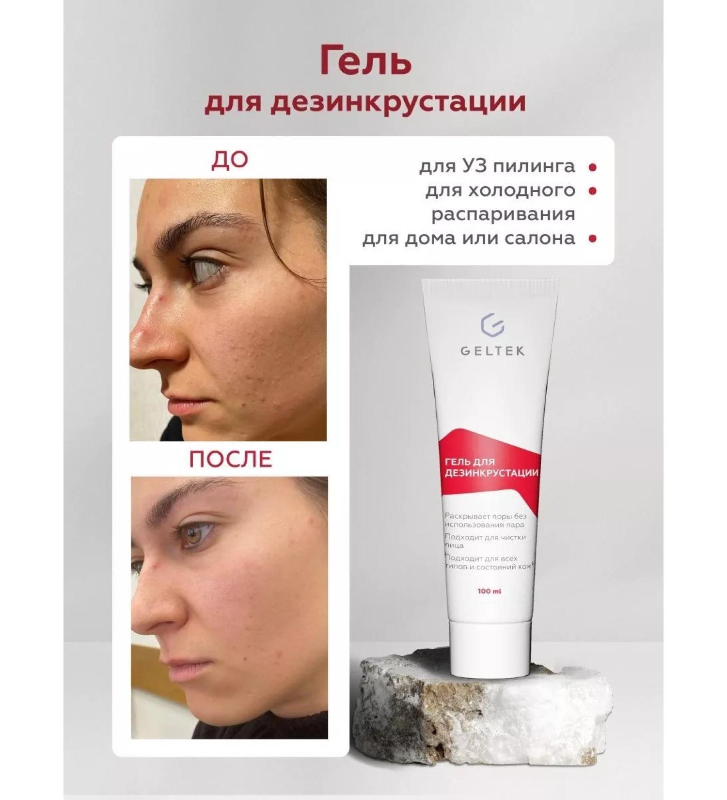 Gel for ultrasonic facial cleansing Uzes 100 ml - Buy Online on GoSupps.com