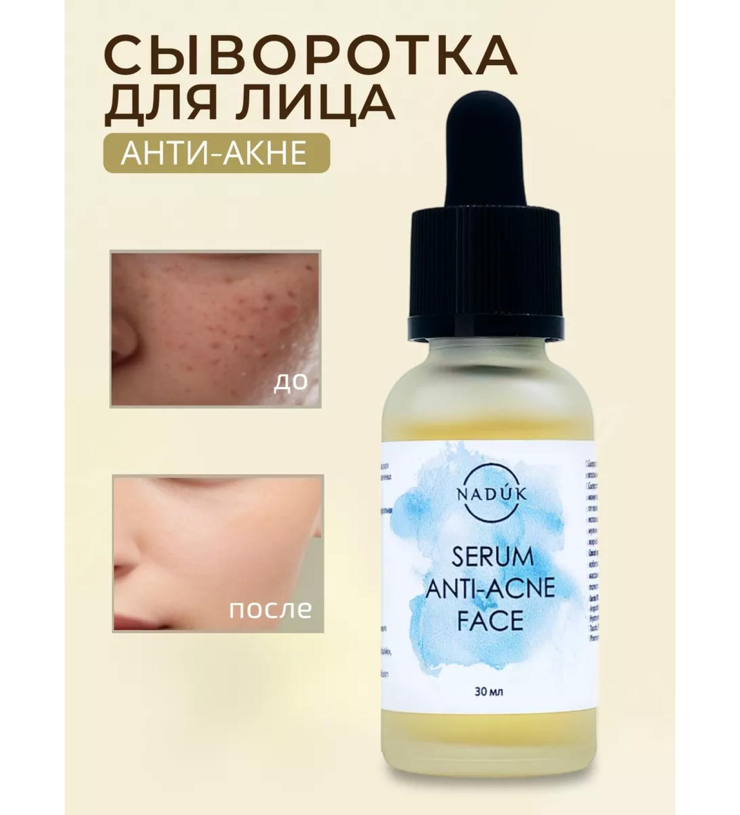 NADUK Facial serum care from acne and acne - Buy Online on GoSupps.com