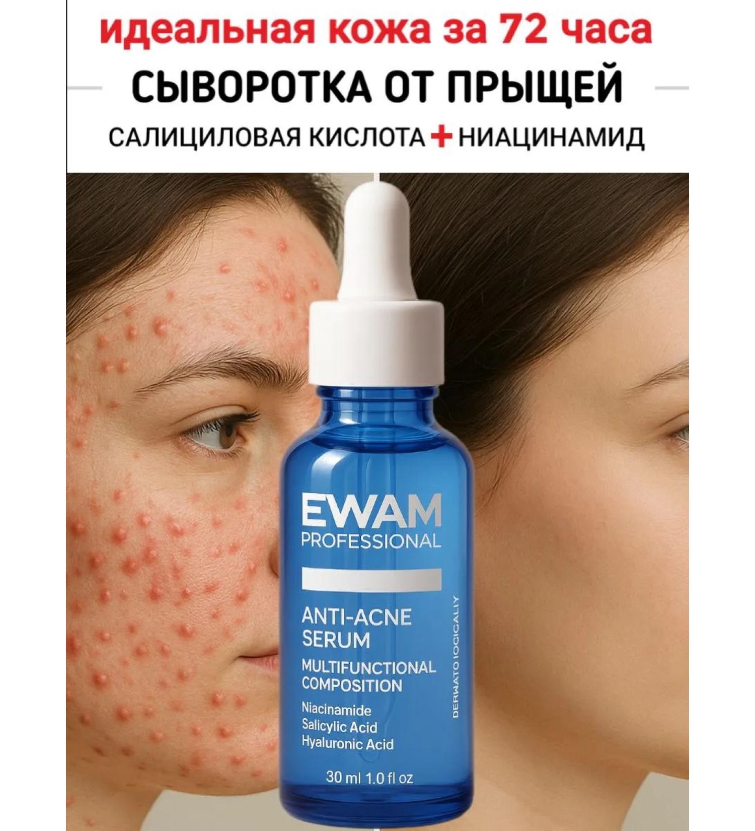 EWAM Acne serum and face acne - Buy Online on GoSupps.com