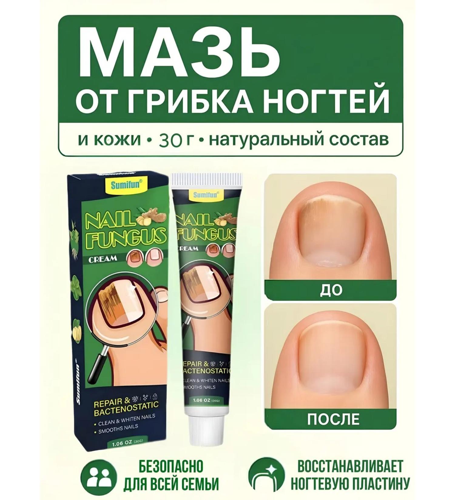 LAMIIA KING Ointment from nail fungus 30 g - Buy Online on GoSupps.com