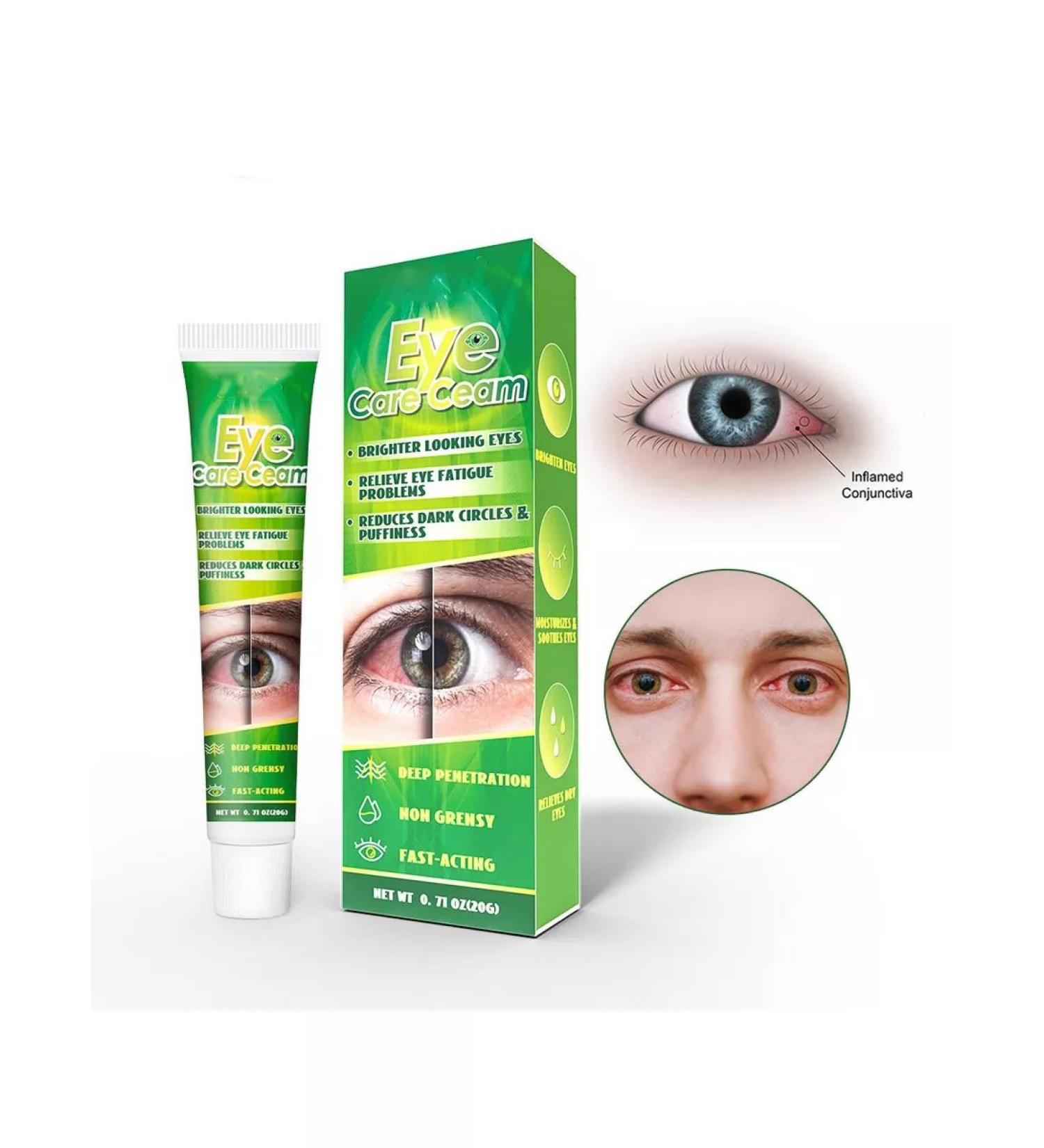 Five stars Eye care cream