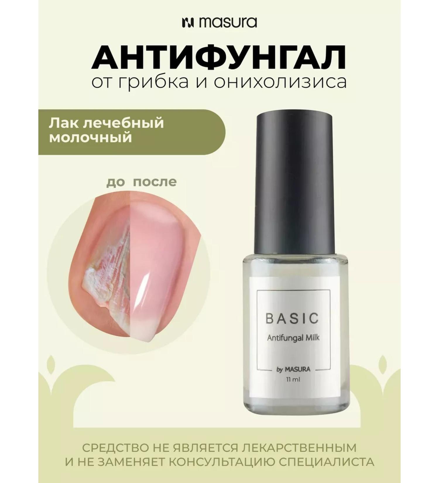 masura Lacques therapeutic antifung from the fungus - Buy Online on GoSupps.com