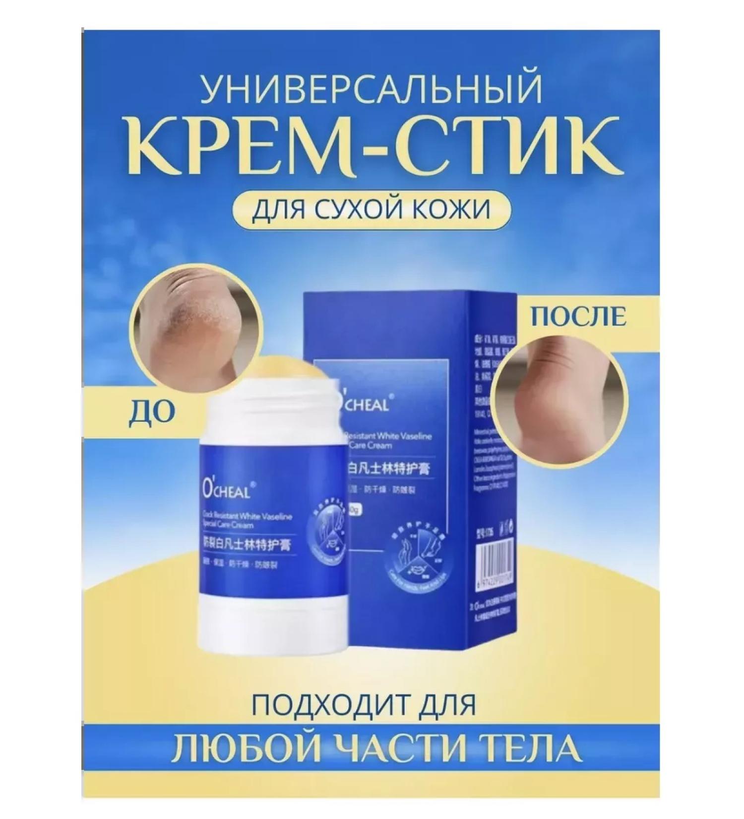 Creams Sting Recovery - Buy Online on GoSupps.com