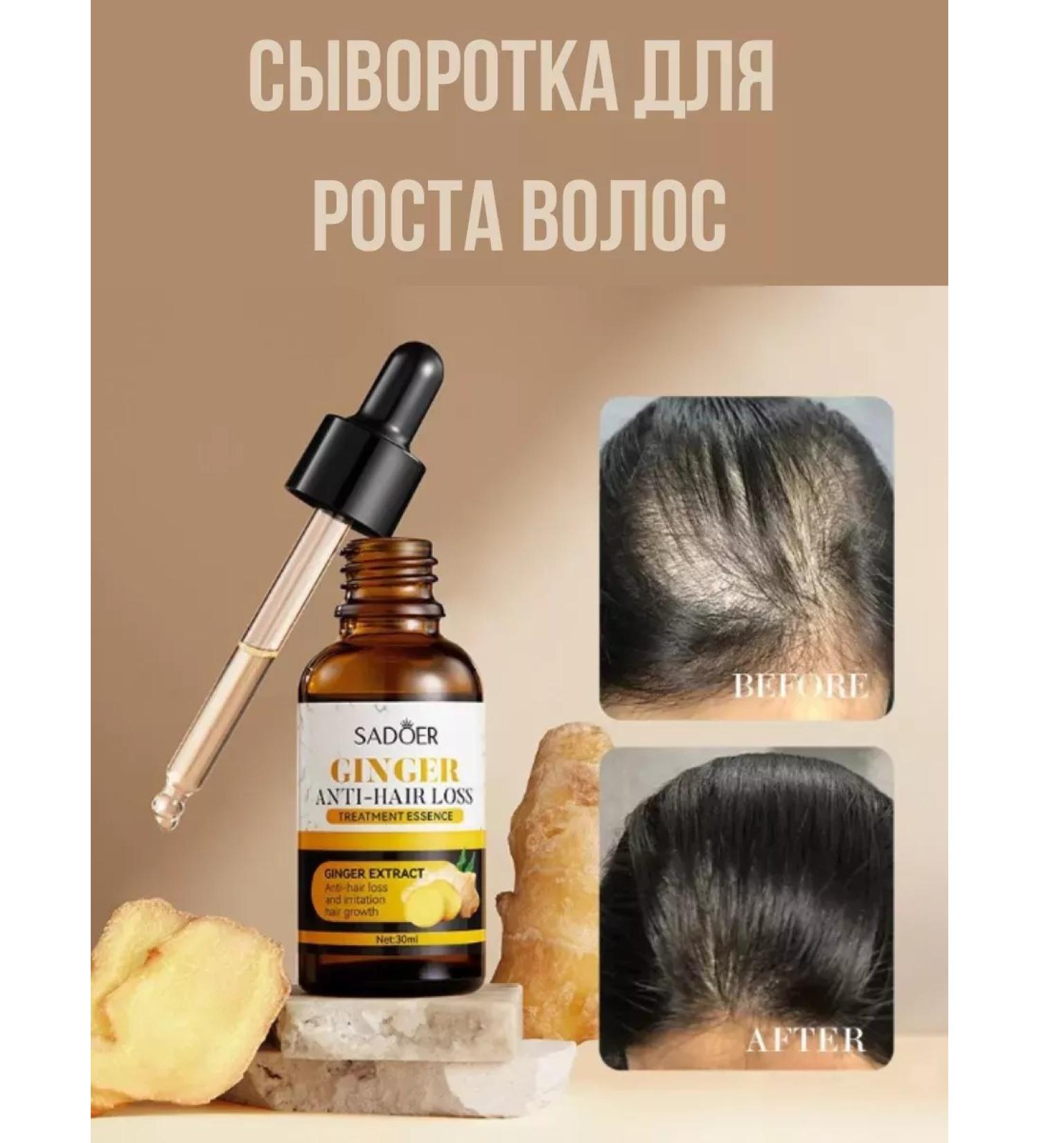 Gold Hair growth serum from hair loss - Buy Online on GoSupps.com