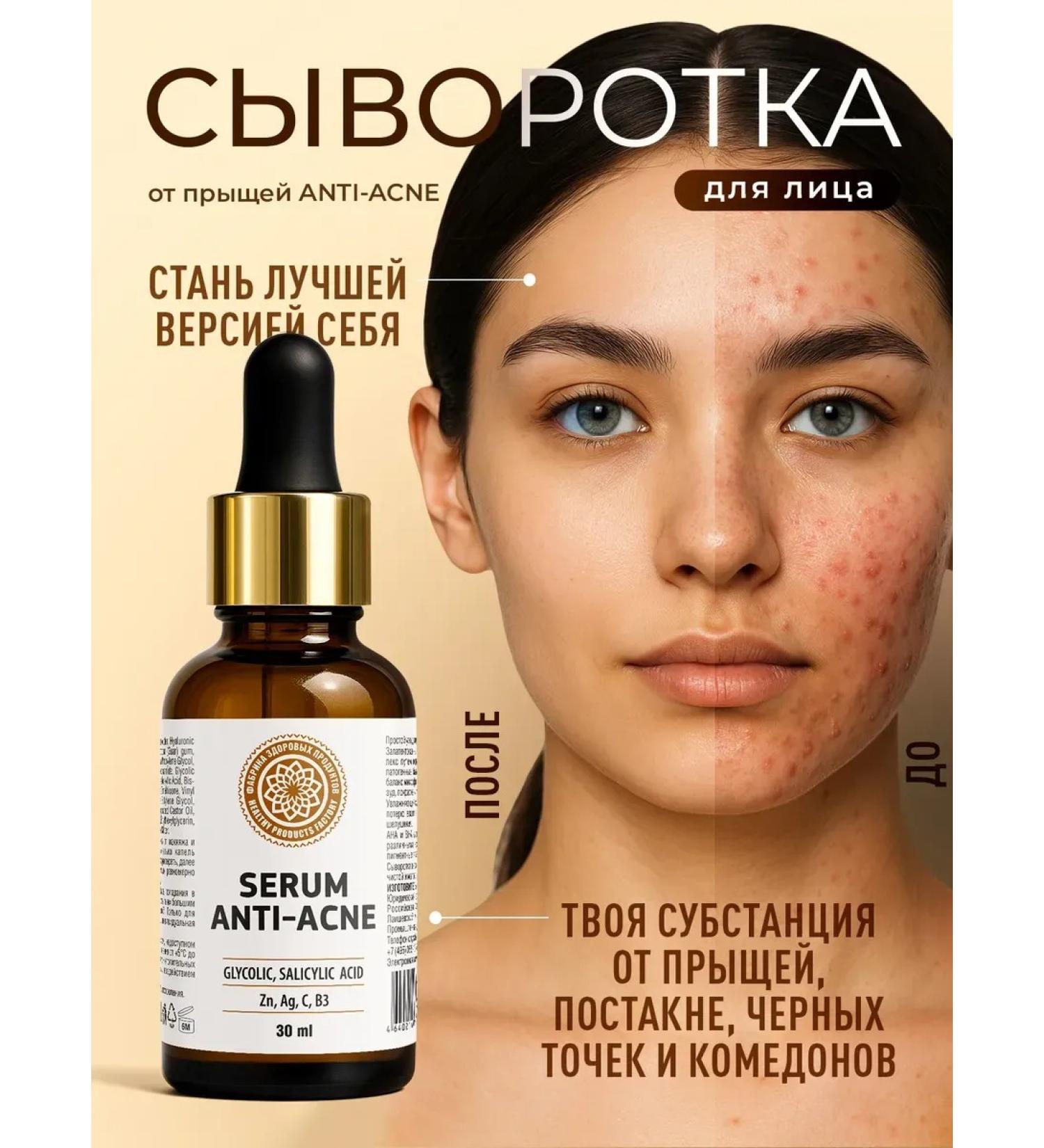 Healthy Products Factory Facial serum from acne and acne - Buy Online on GoSupps.com