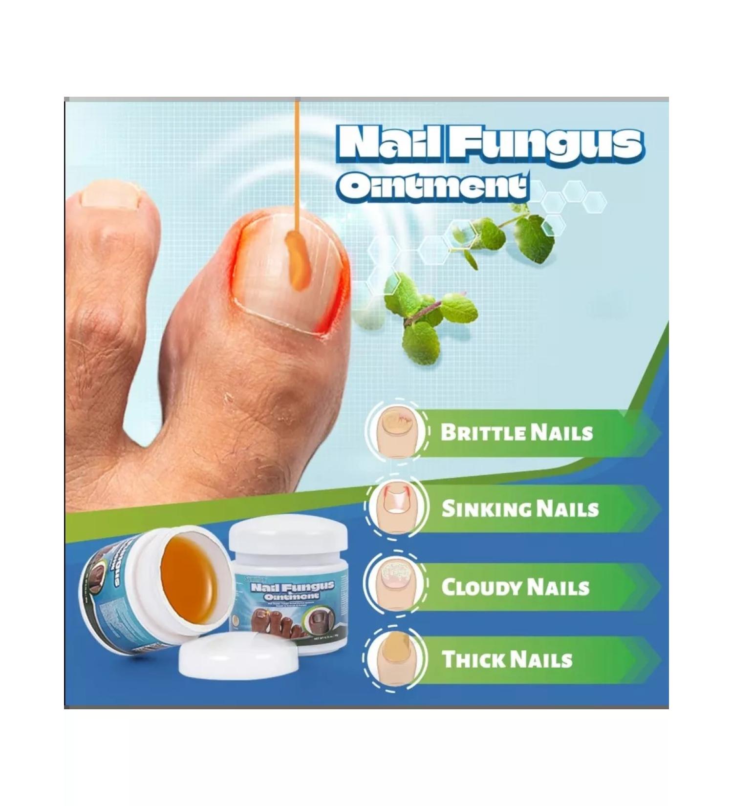 Doril Chinese ointment from nail fungus - Buy Online on GoSupps.com